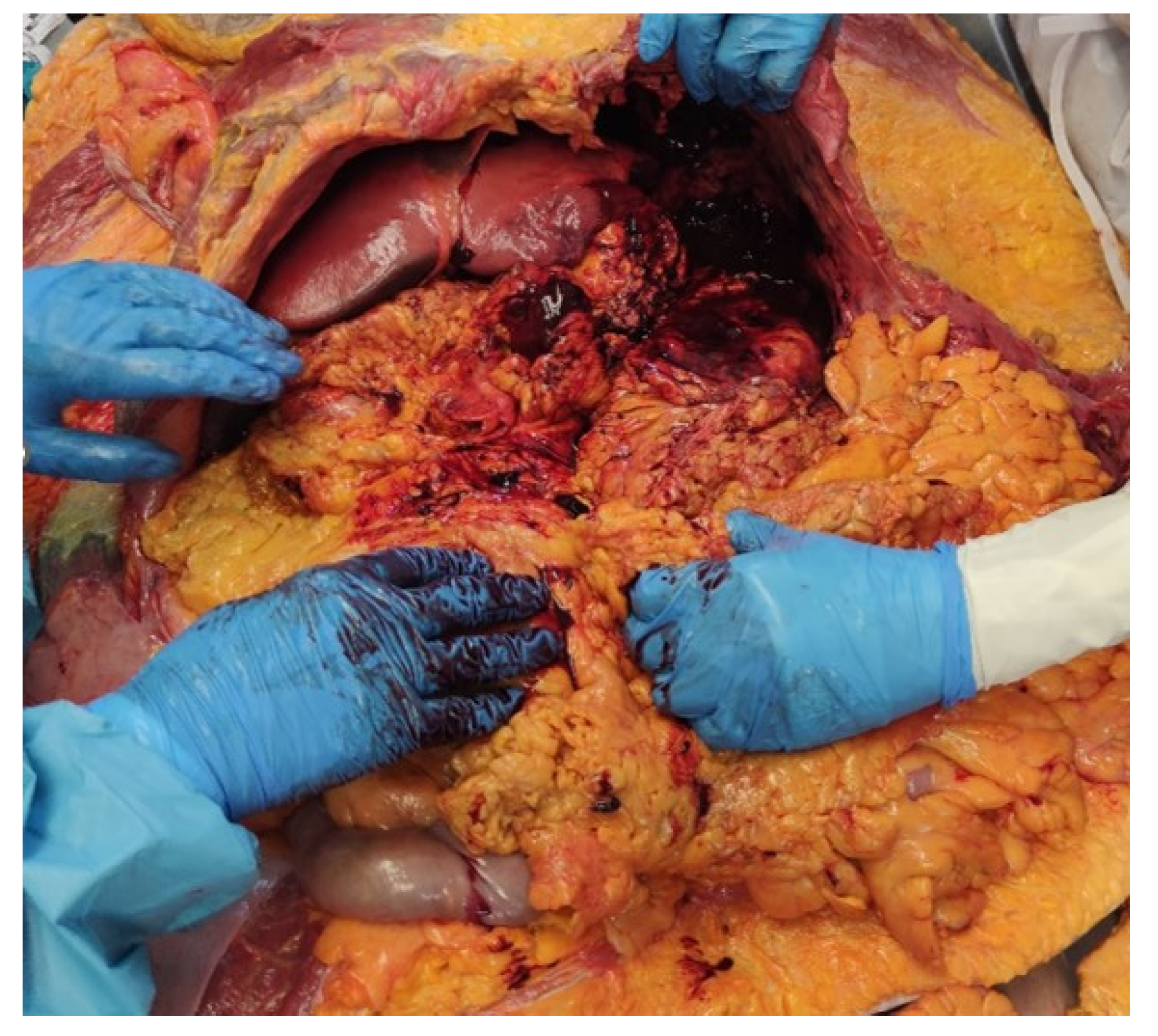 Diagnostics 14 01254 g001