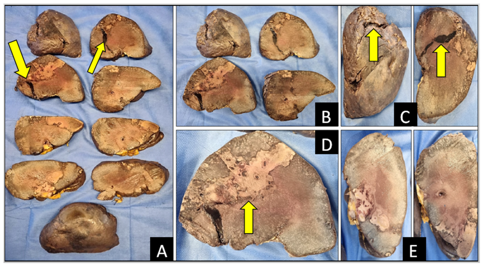 Diagnostics 14 01254 g003