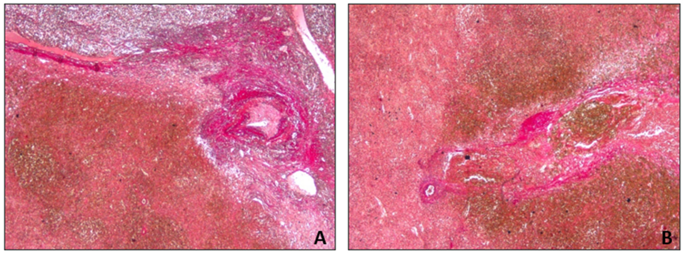 Diagnostics 14 01254 g006