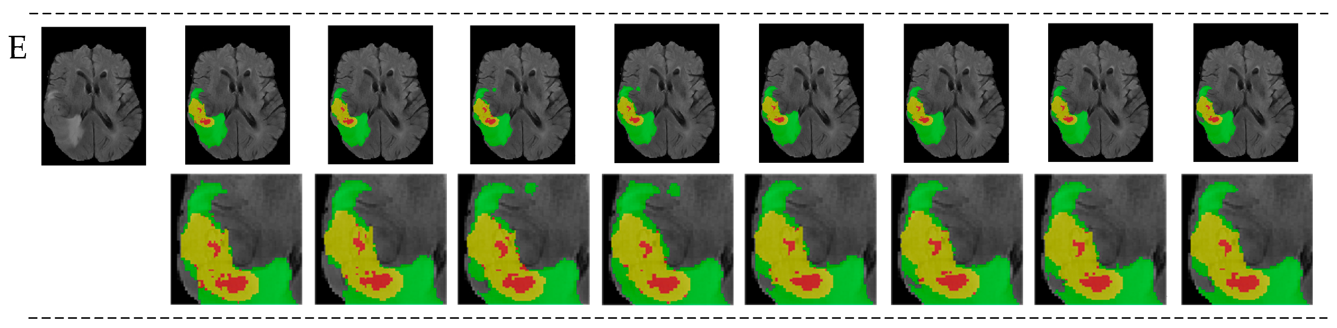 Diagnostics 14 01257 g008b