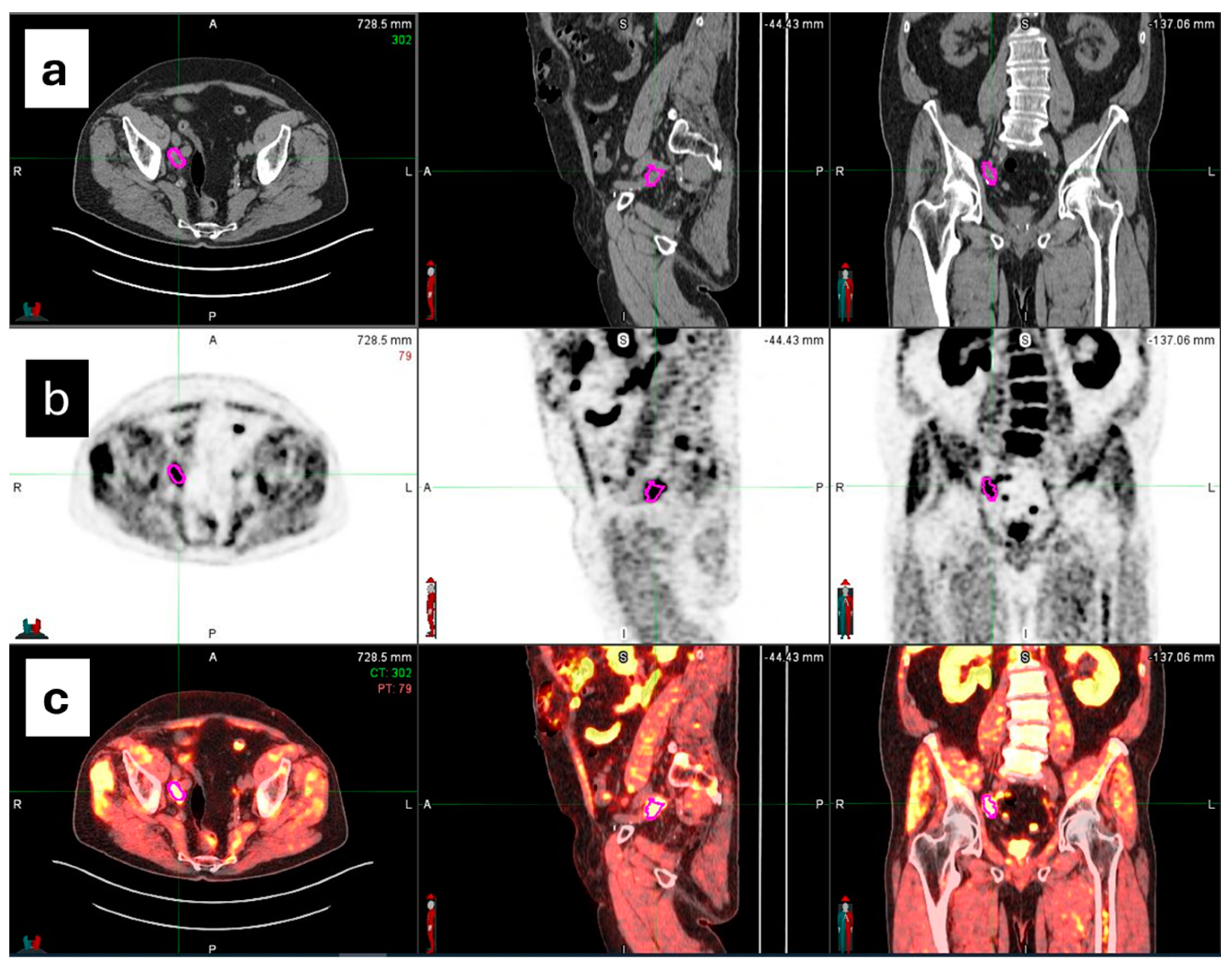 Diagnostics 14 01264 g002