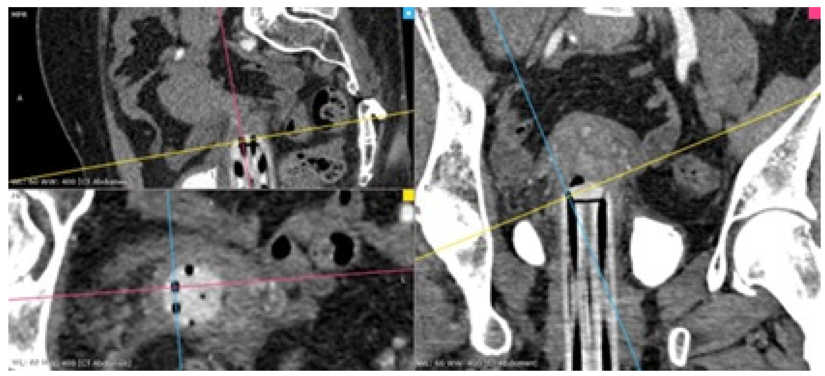 Diagnostics 14 01267 g001