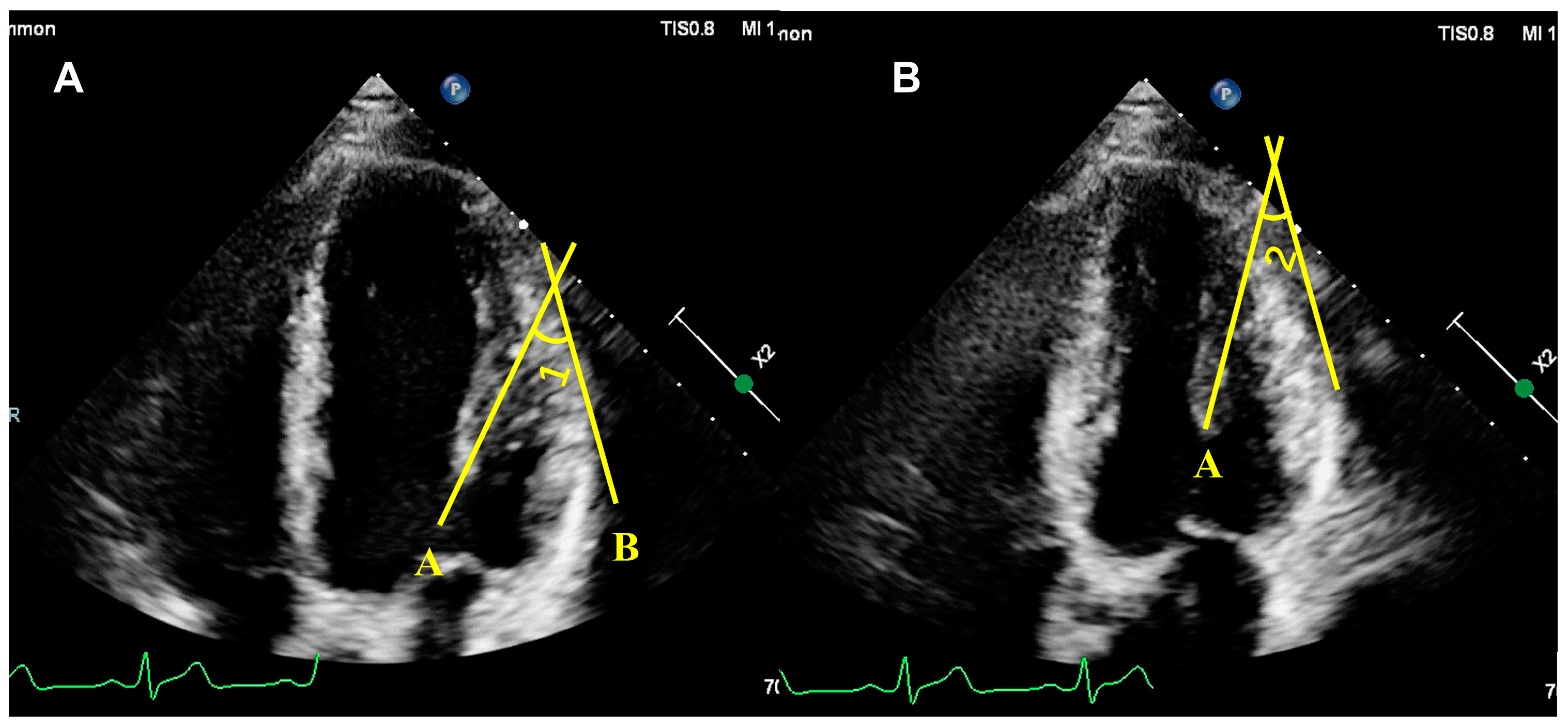 Diagnostics 14 01270 g004 Diagnostics 14 01270 g004