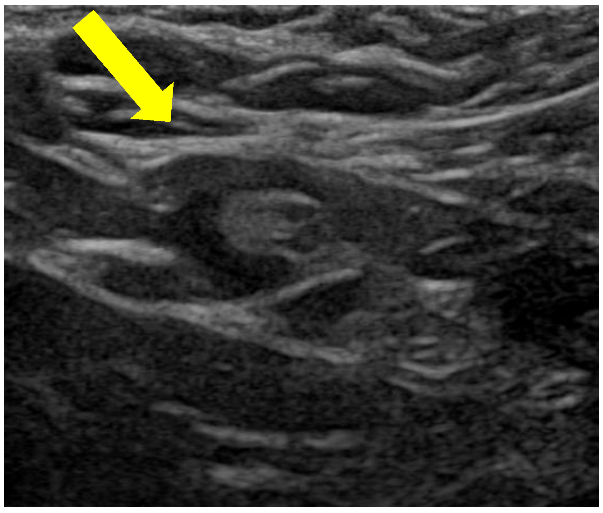 Diagnostics 14 01272 g002 Diagnostics 14 01272 g002