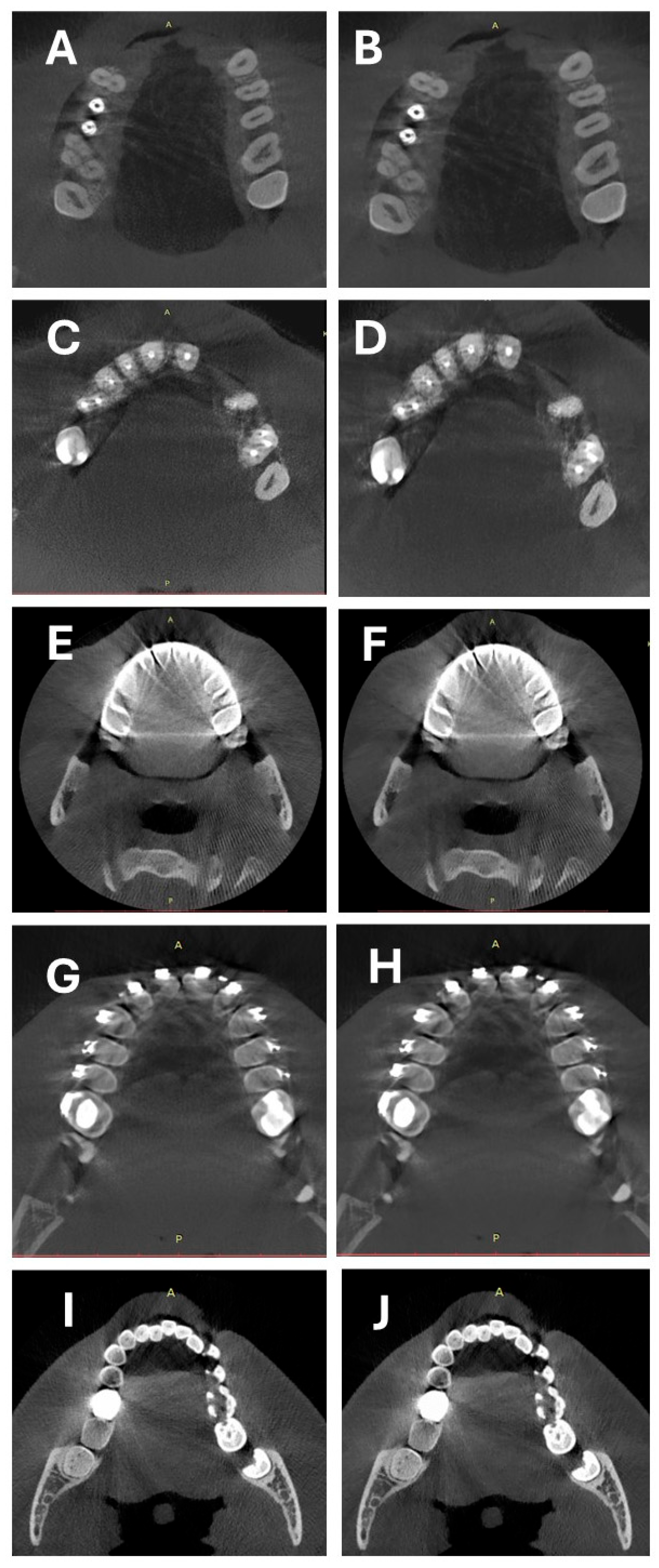 Diagnostics 14 01280 g004