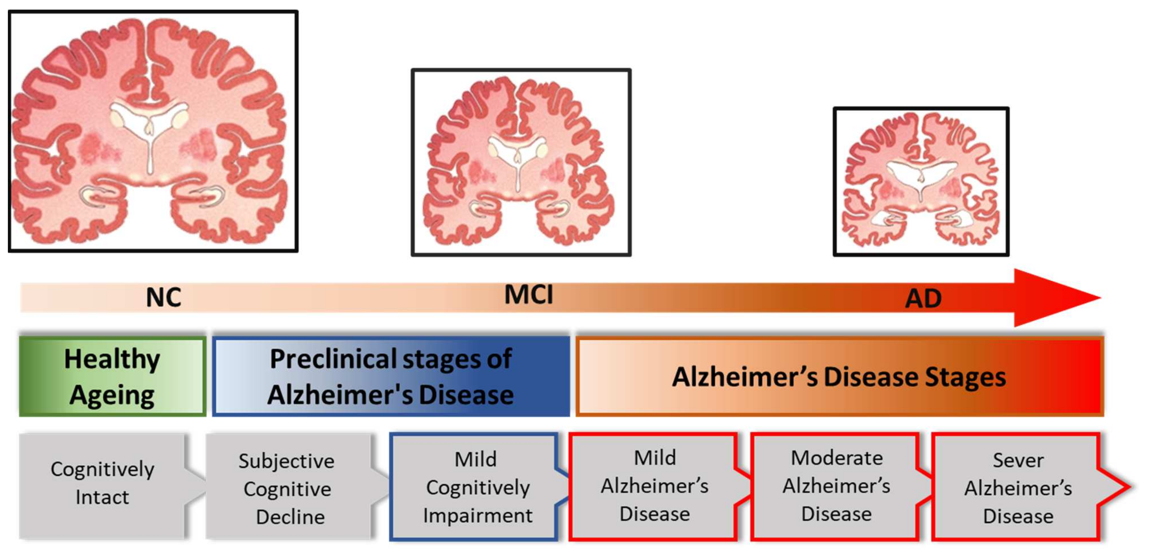 Deep Learning for Alzheimer's Disease Prediction: A