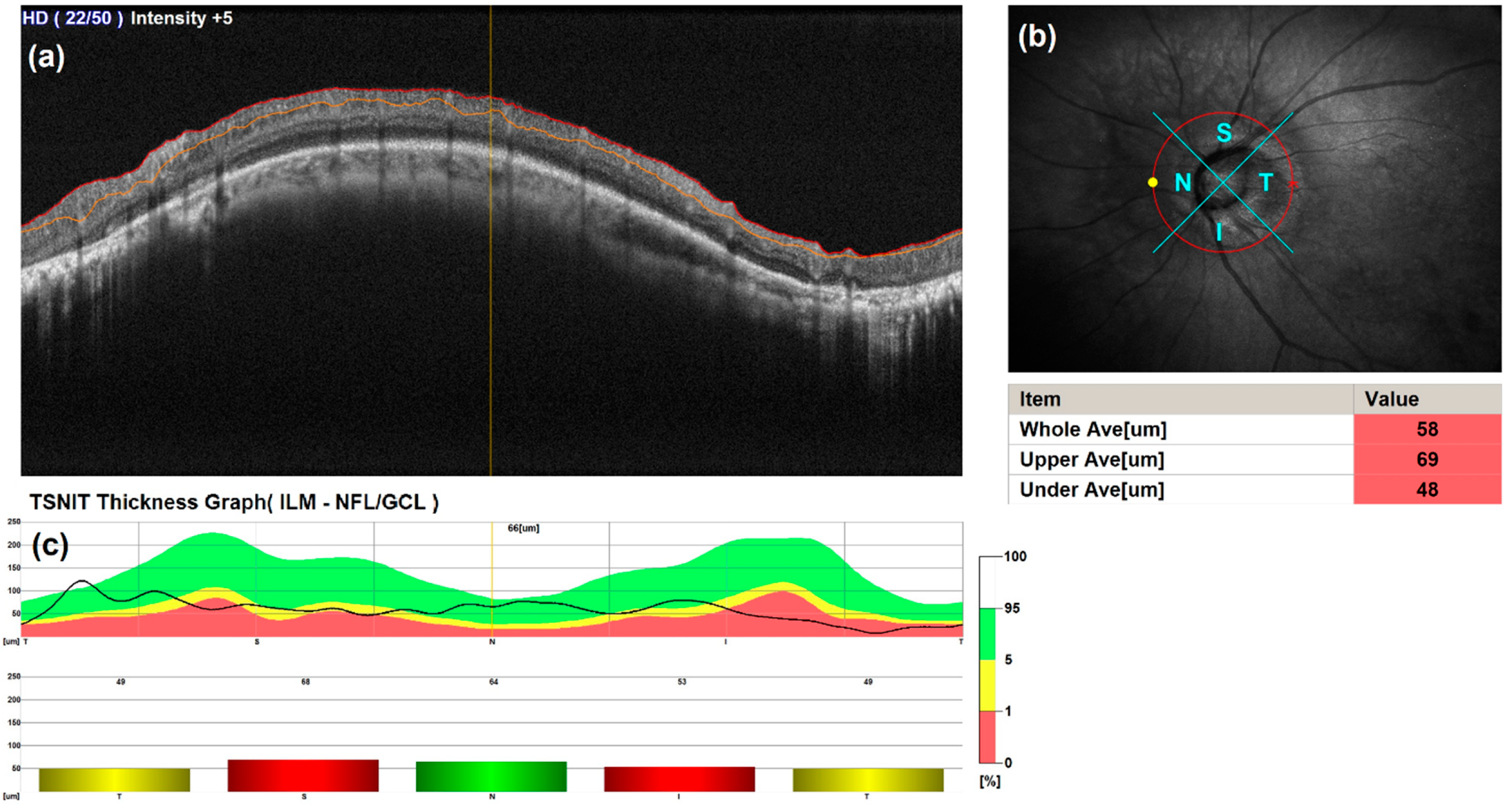 Diagnostics 14 01285 g002