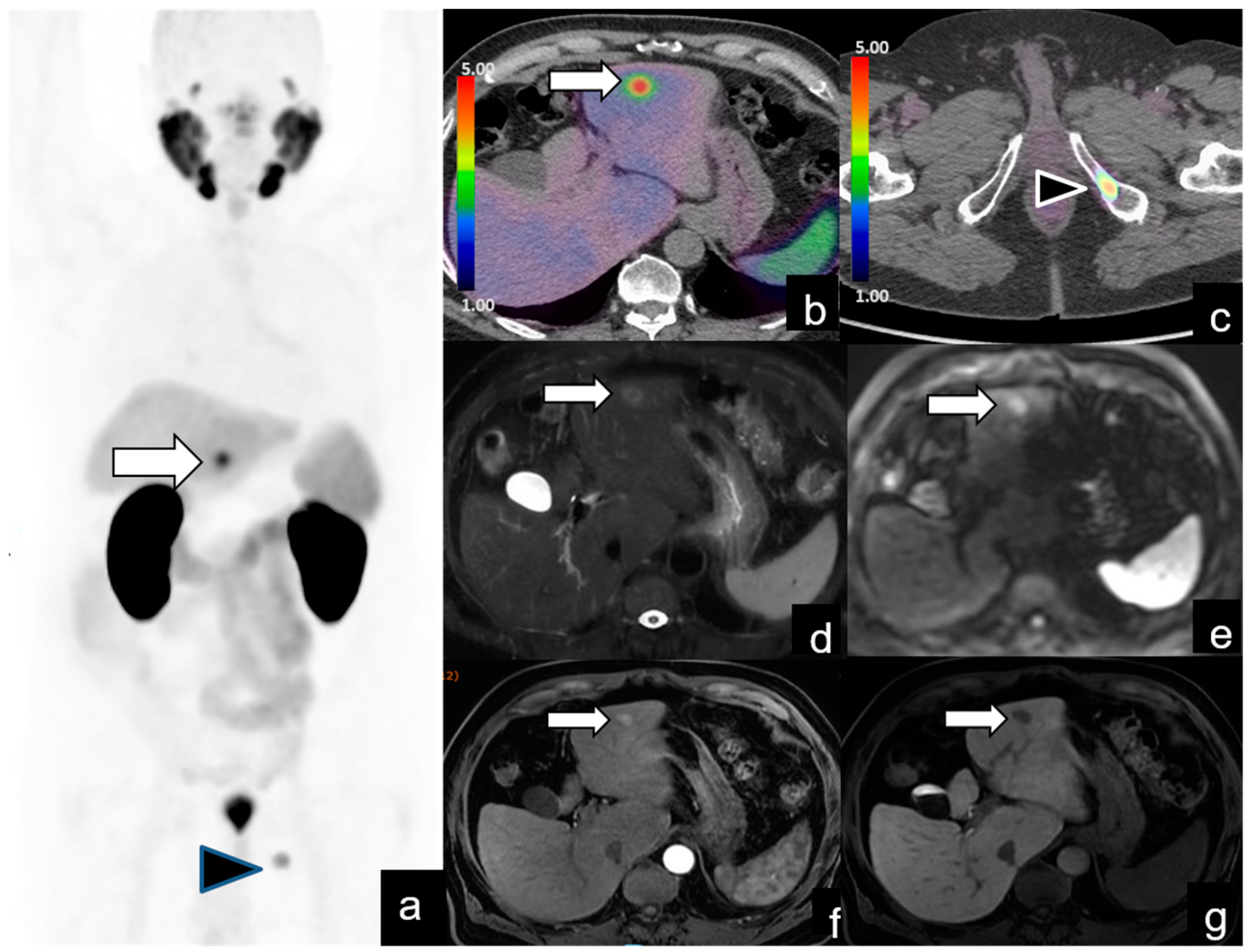 Diagnostics 14 01291 g004