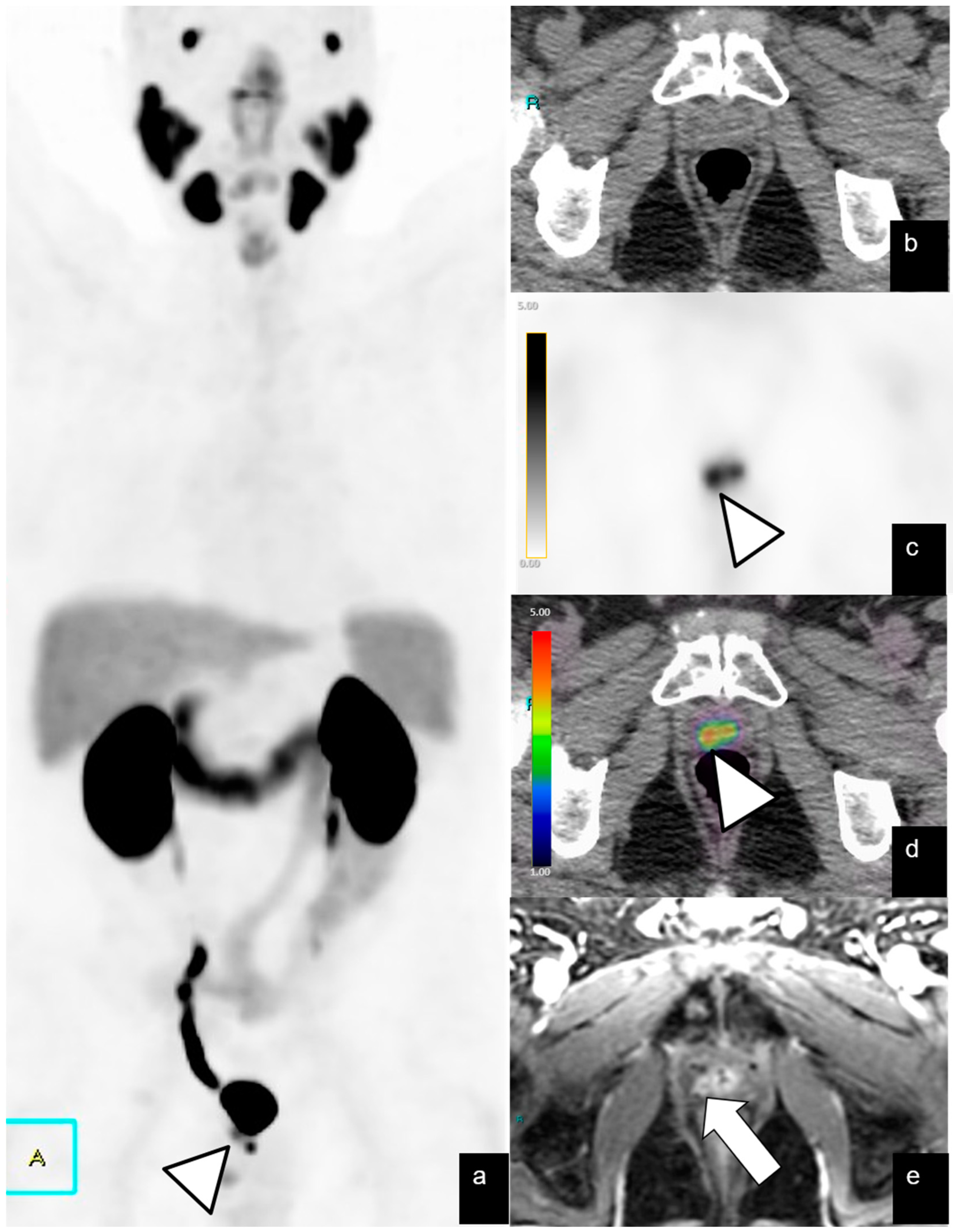 Diagnostics 14 01291 g005