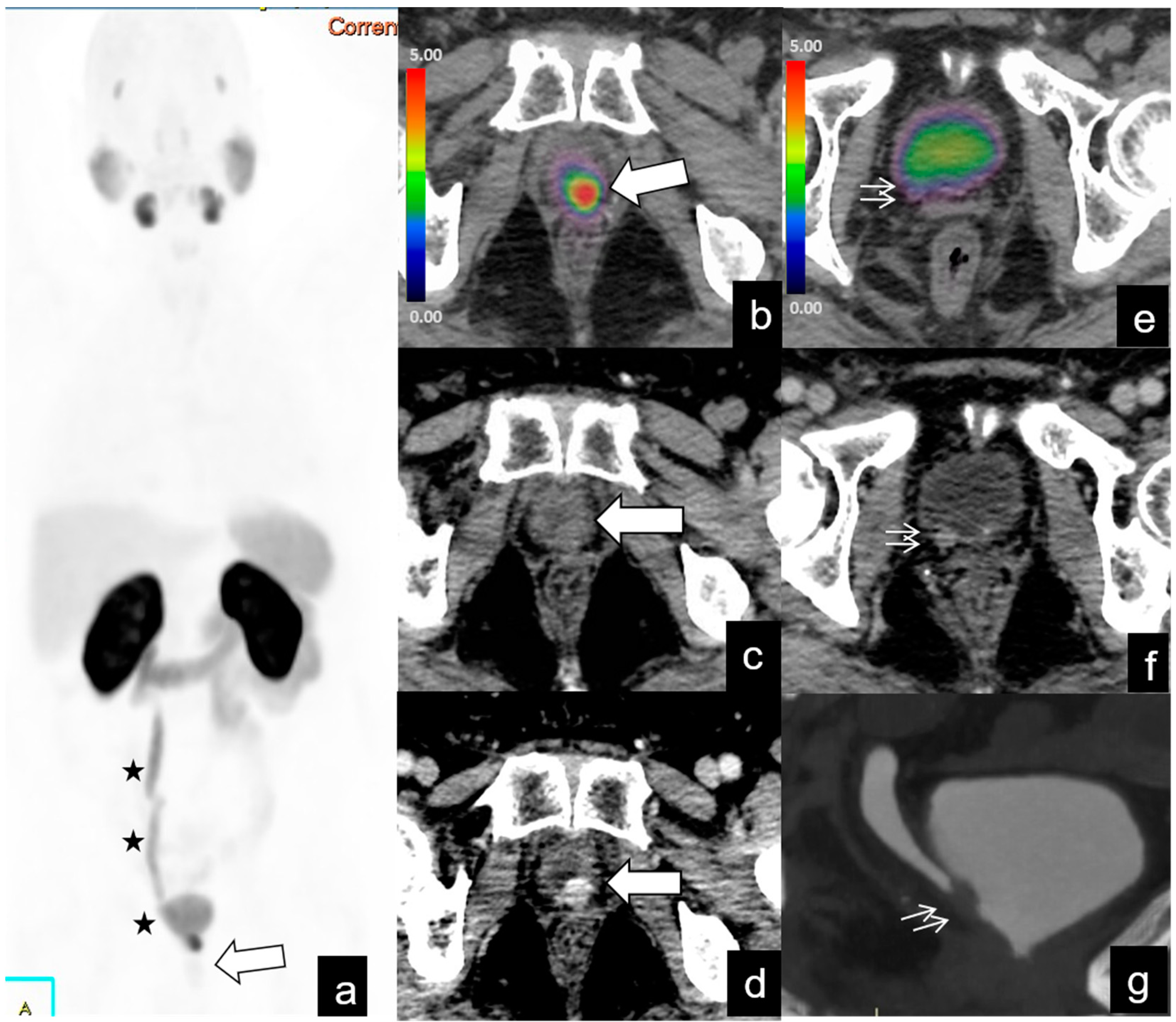 Diagnostics 14 01291 g007
