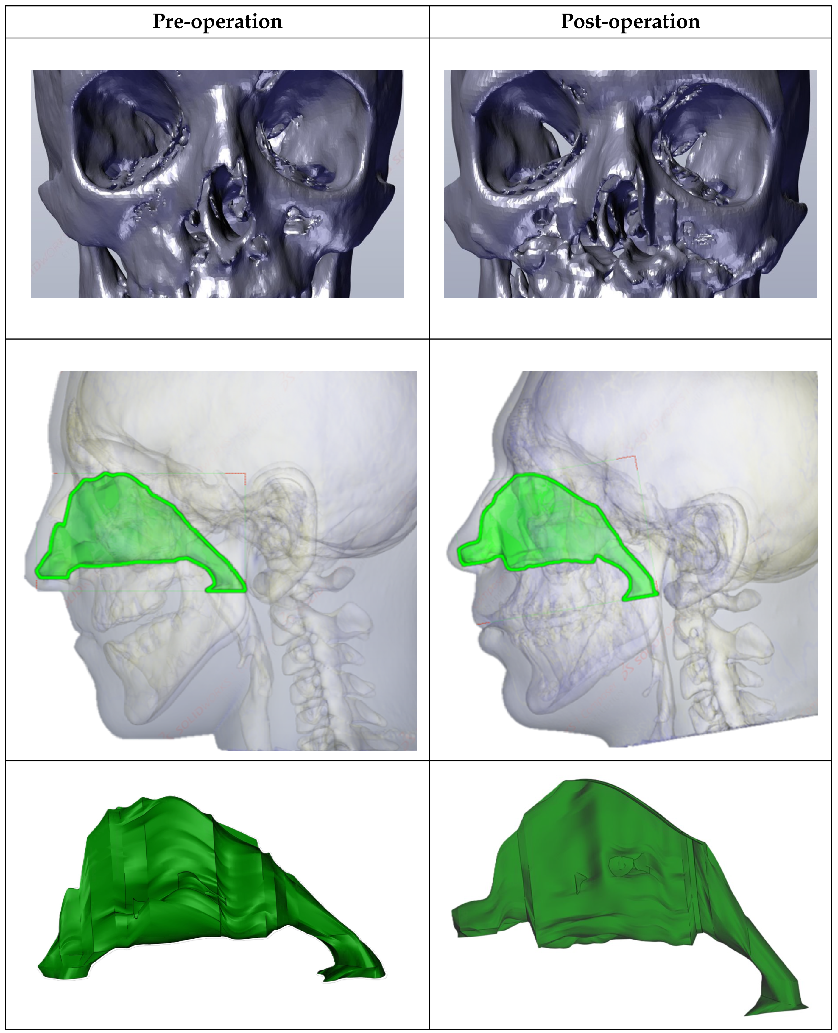 Diagnostics 14 01294 g001