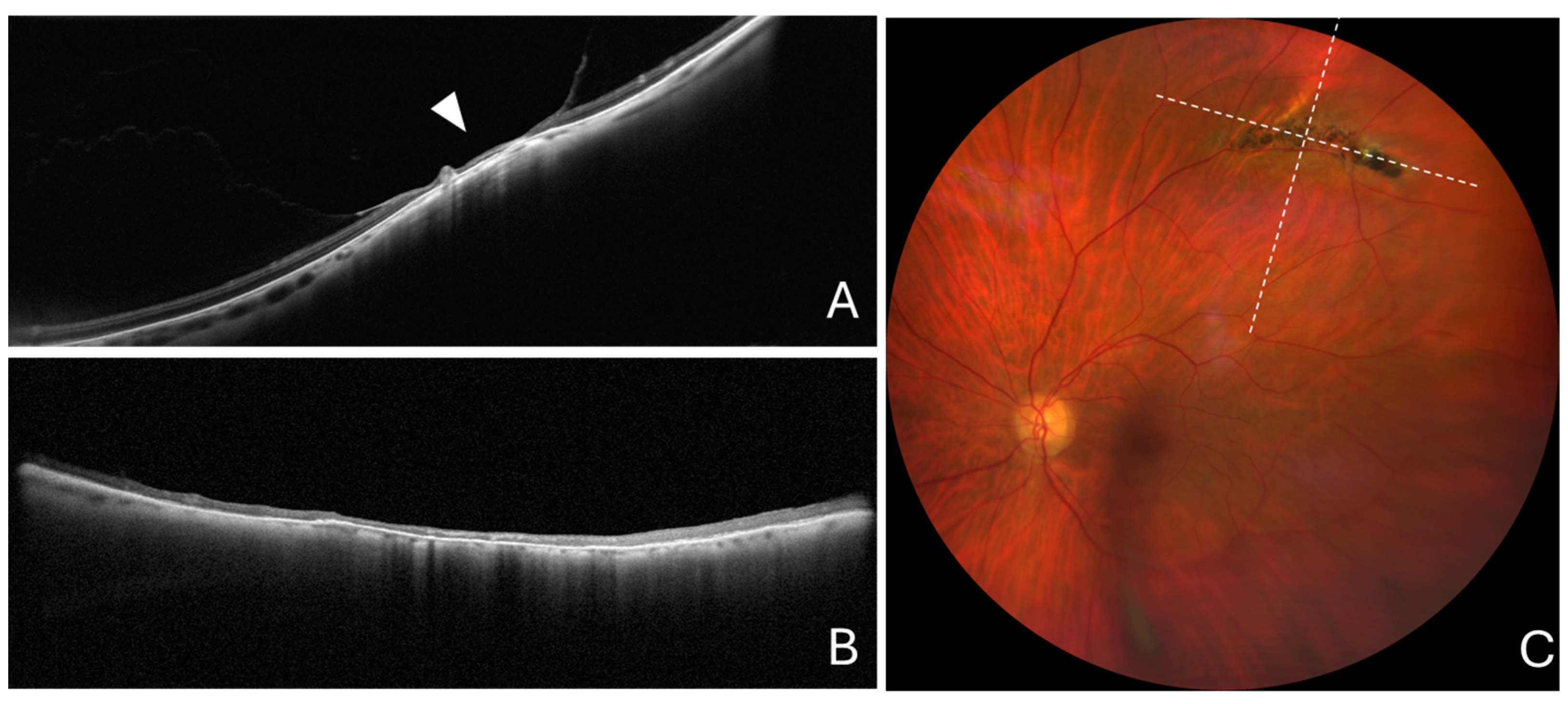 Diagnostics 14 01295 g003