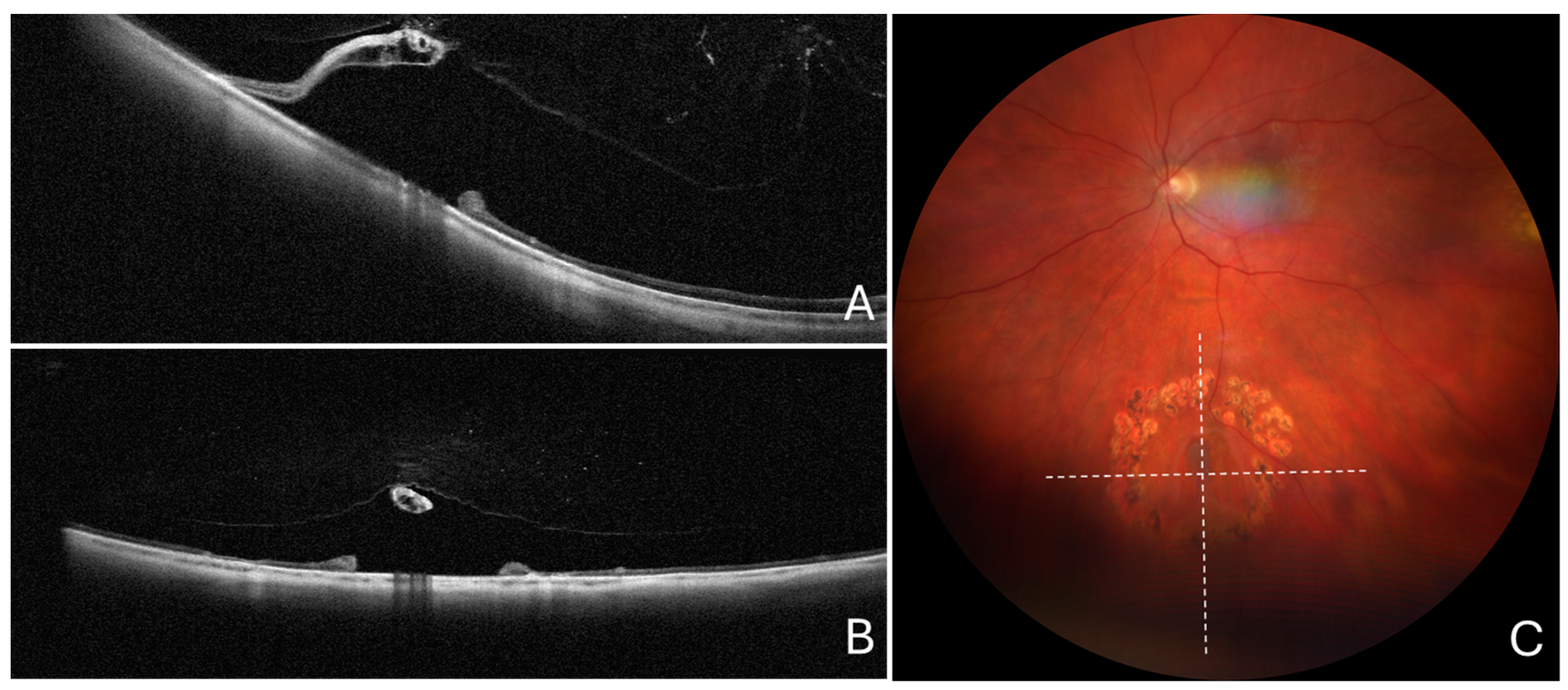 Diagnostics 14 01295 g005