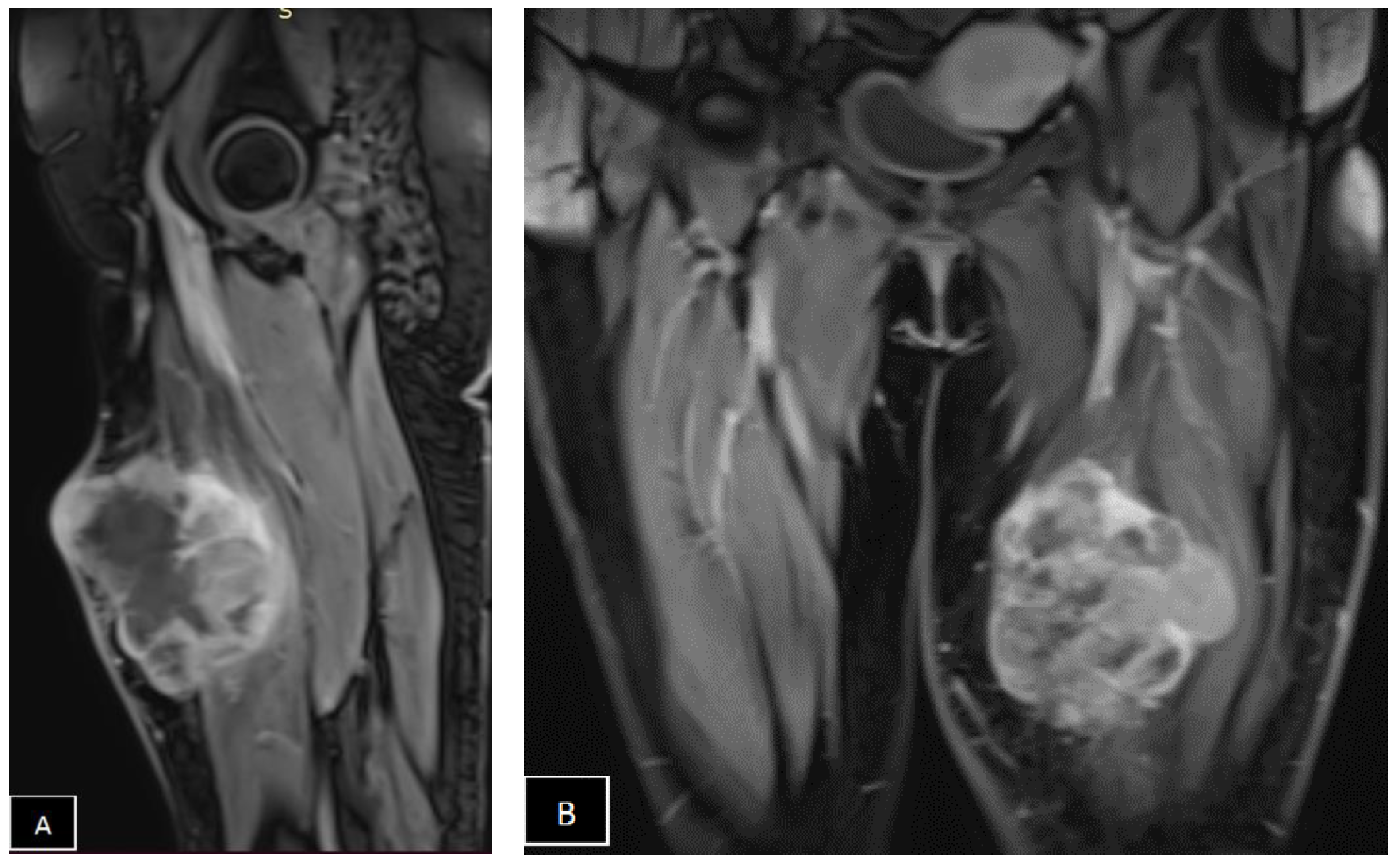 Diagnostics 14 01298 g002a