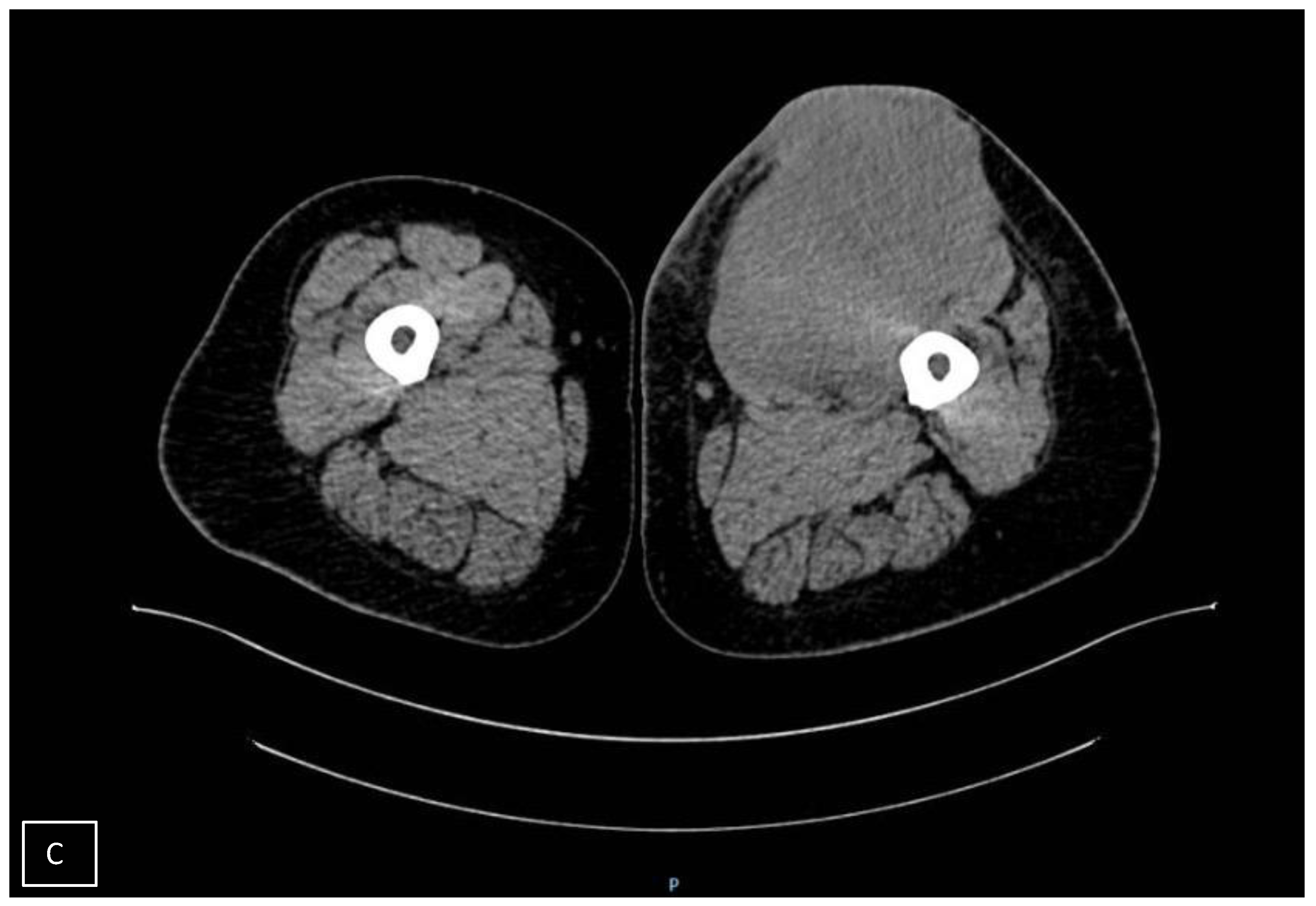Diagnostics 14 01298 g002b