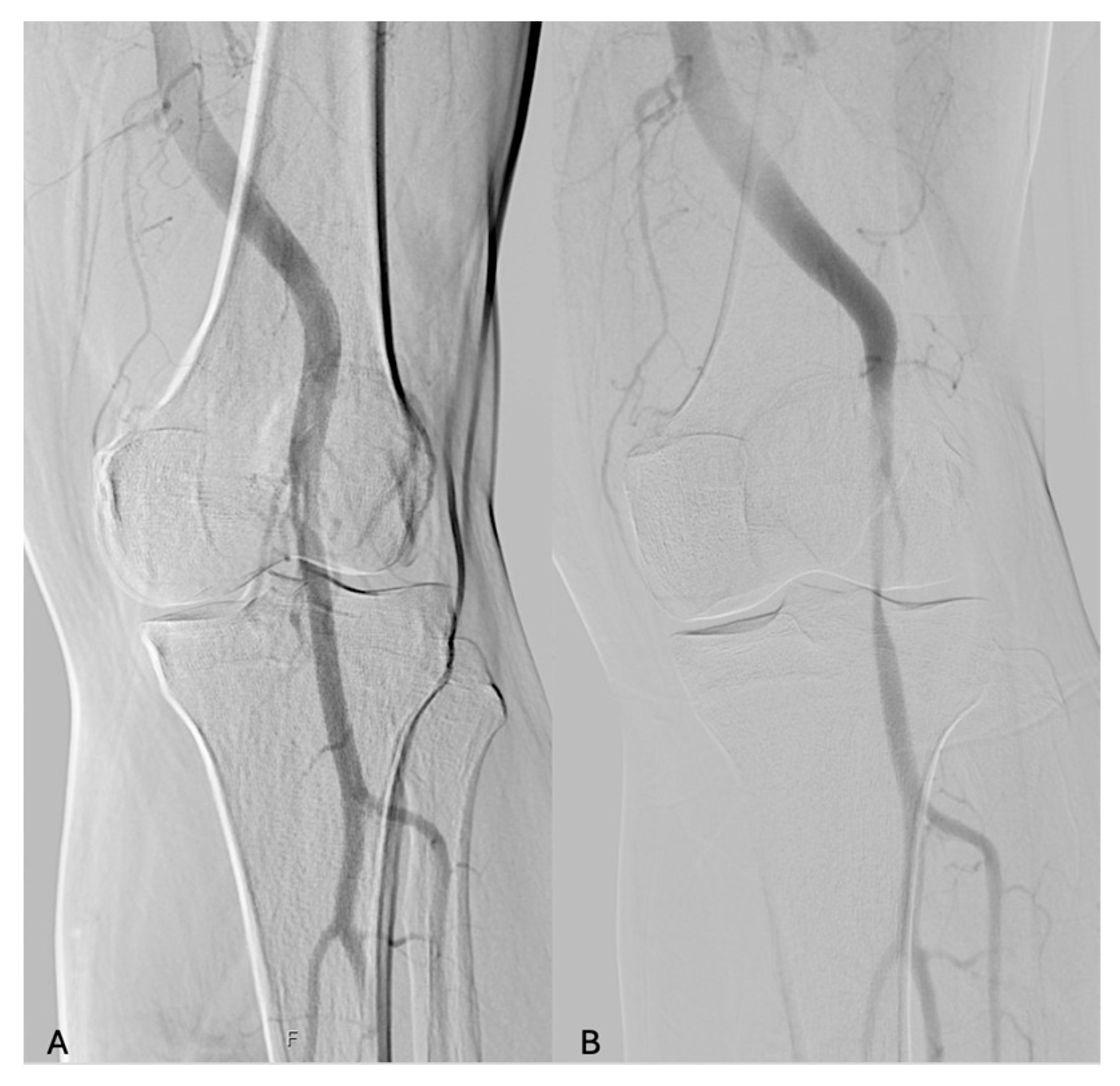 Diagnostics 14 01302 g001