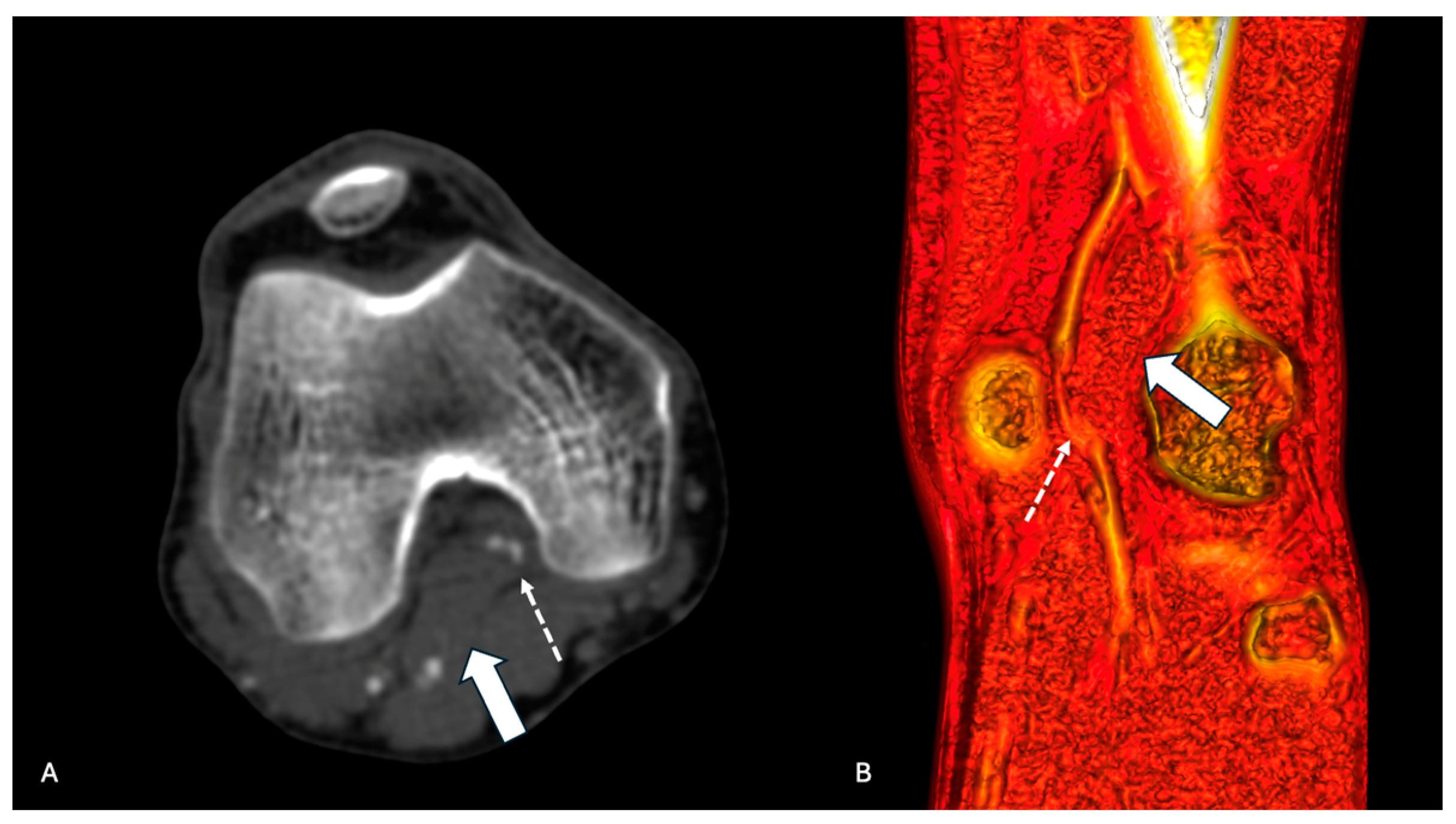 Diagnostics 14 01302 g002
