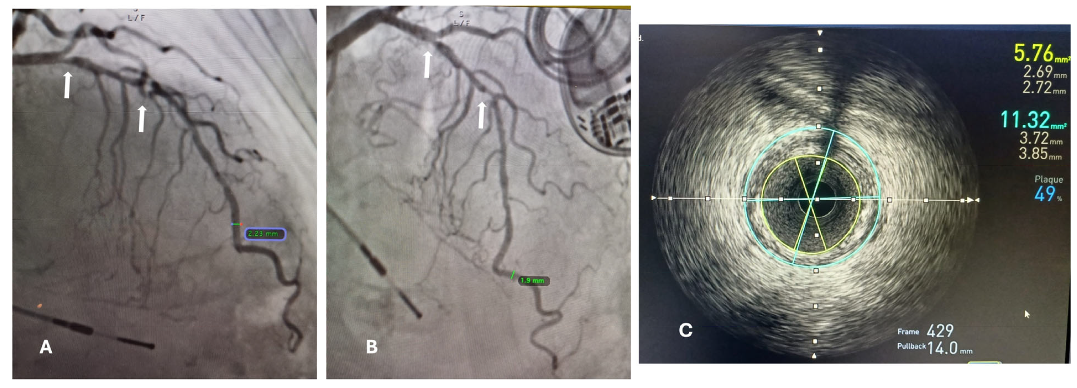 Diagnostics 14 01312 g001
