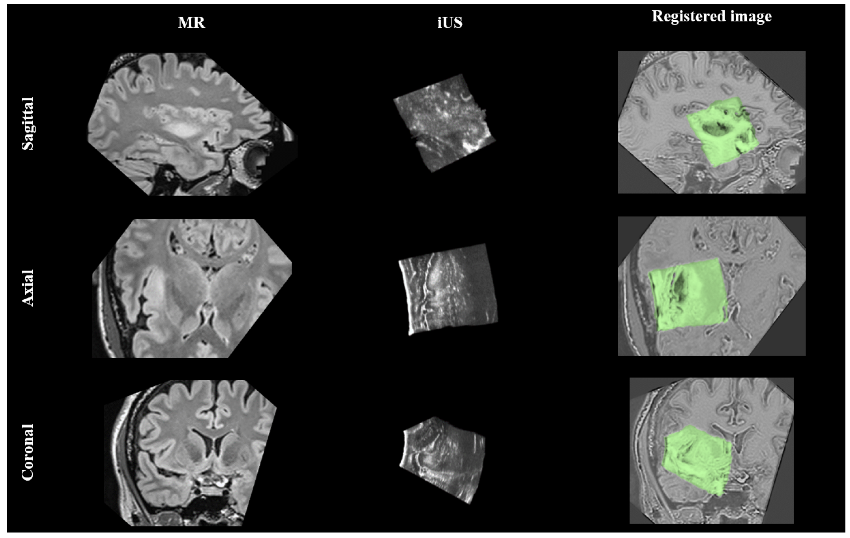 Diagnostics 14 01319 g005