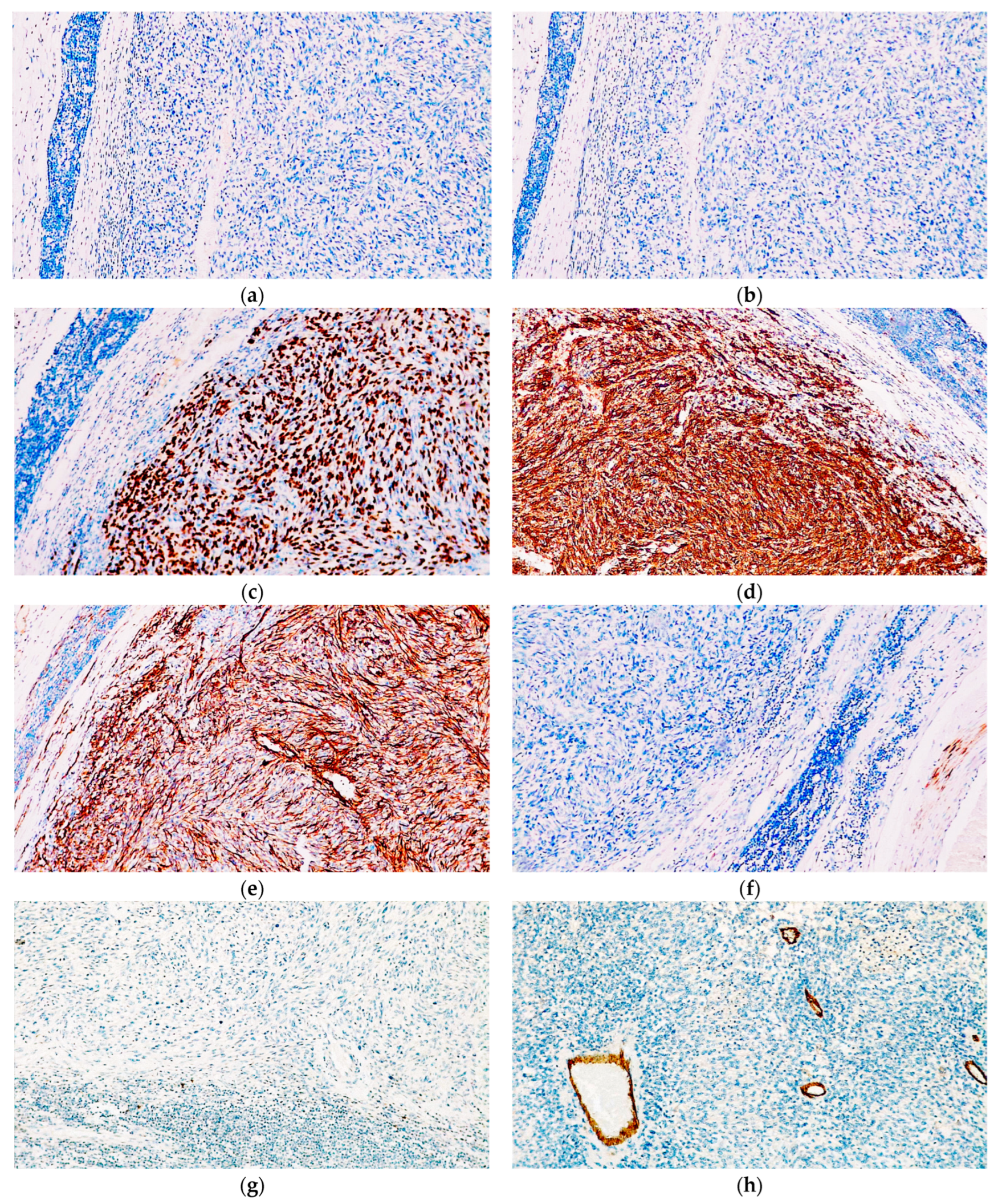 Diagnostics 14 01323 g005a Diagnostics 14 01323 g005a