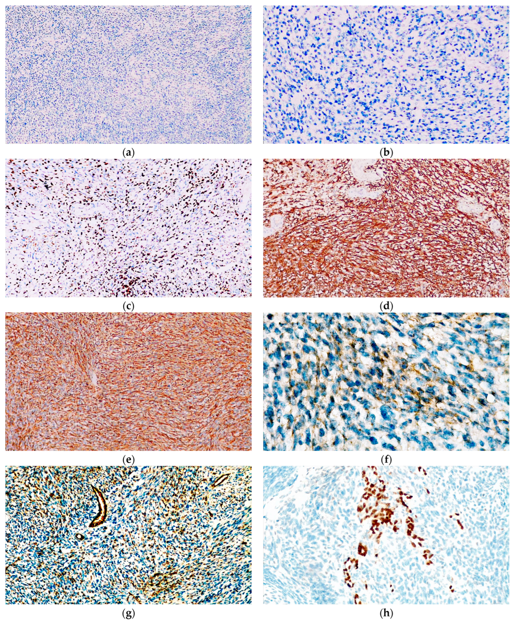 Diagnostics 14 01323 g007 Diagnostics 14 01323 g007