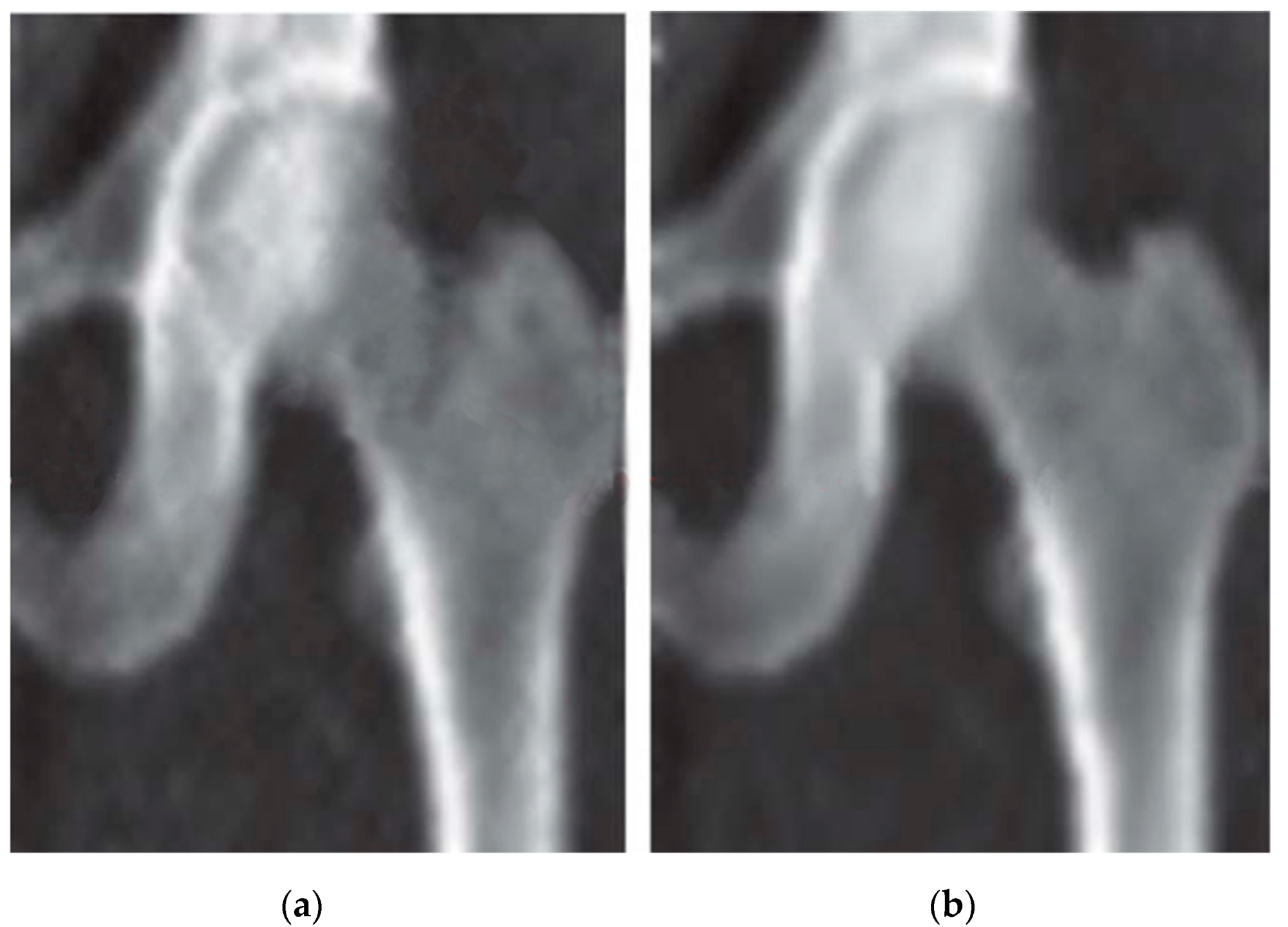 Diagnostics 14 01328 g005