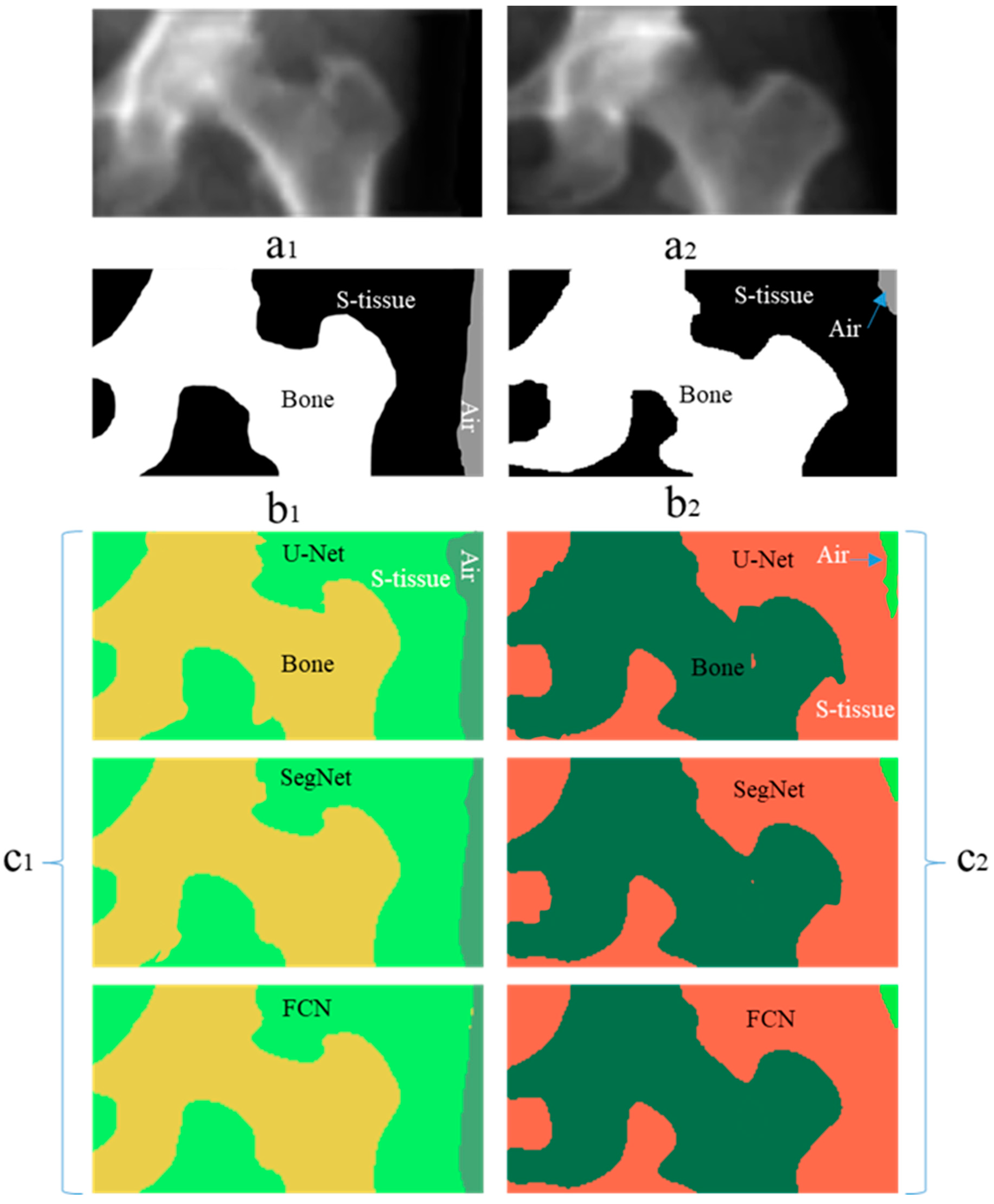 Diagnostics 14 01328 g006