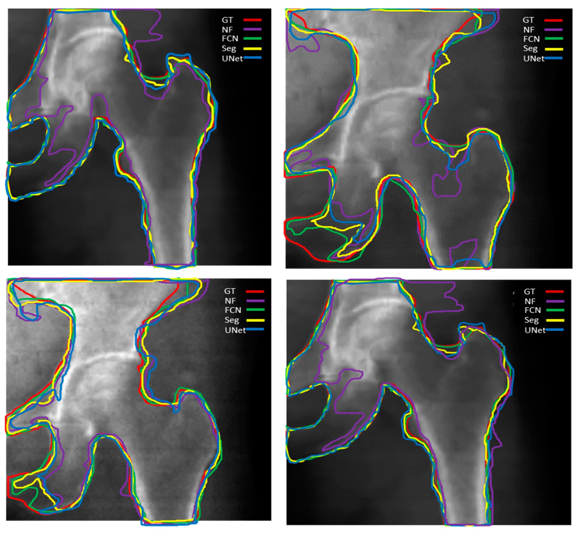 Diagnostics 14 01328 g008