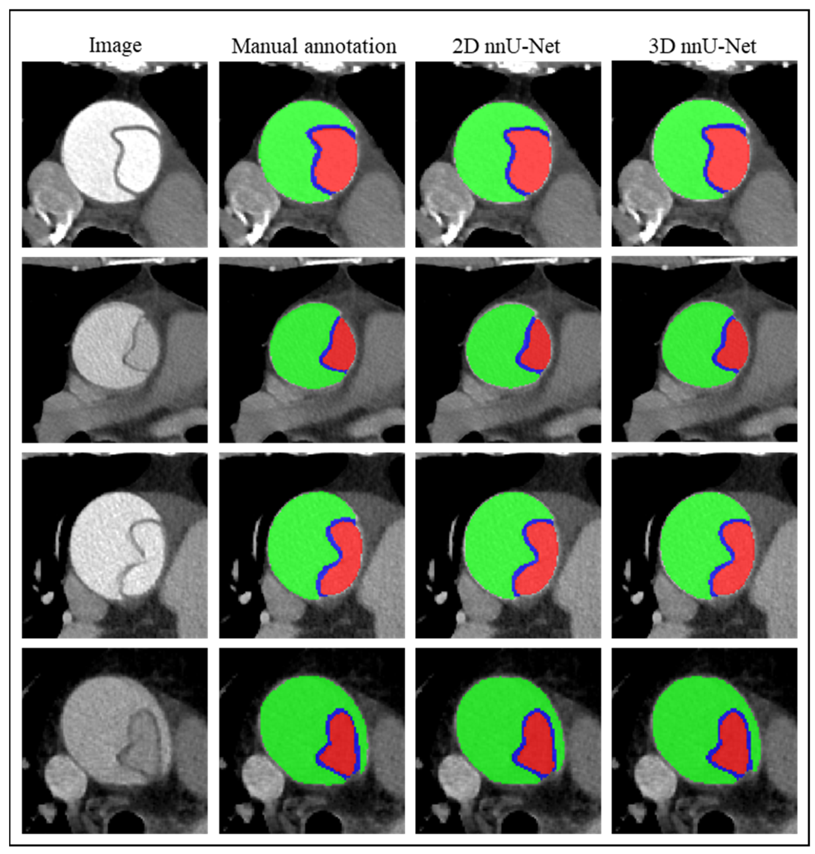 Diagnostics 14 01332 g004