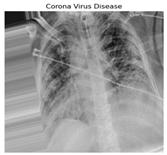 Diagnostics 14 01334 i003