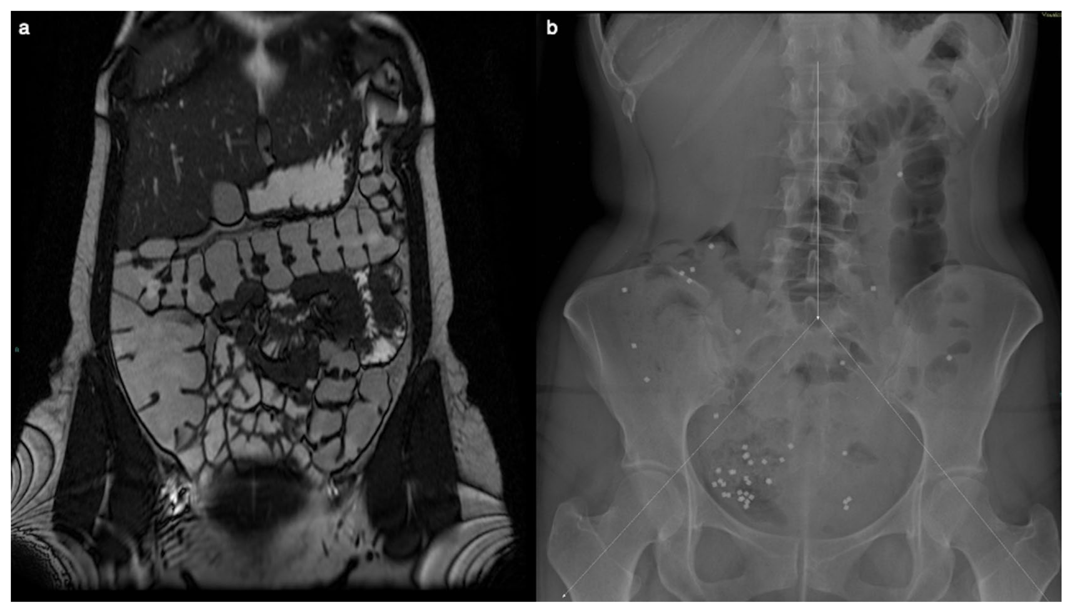 Diagnostics 14 01337 g001 Diagnostics 14 01337 g001