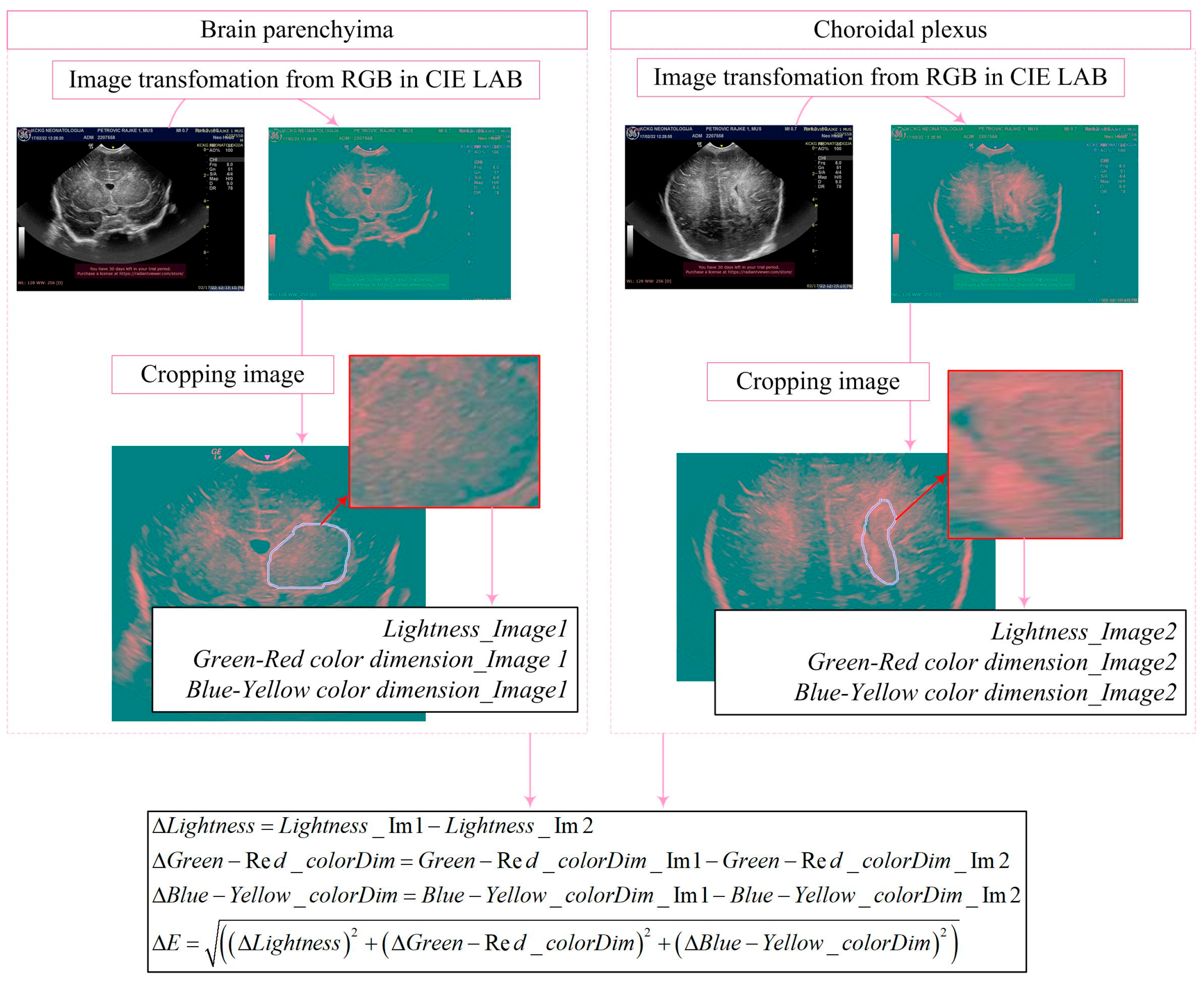 Diagnostics 14 01342 g003