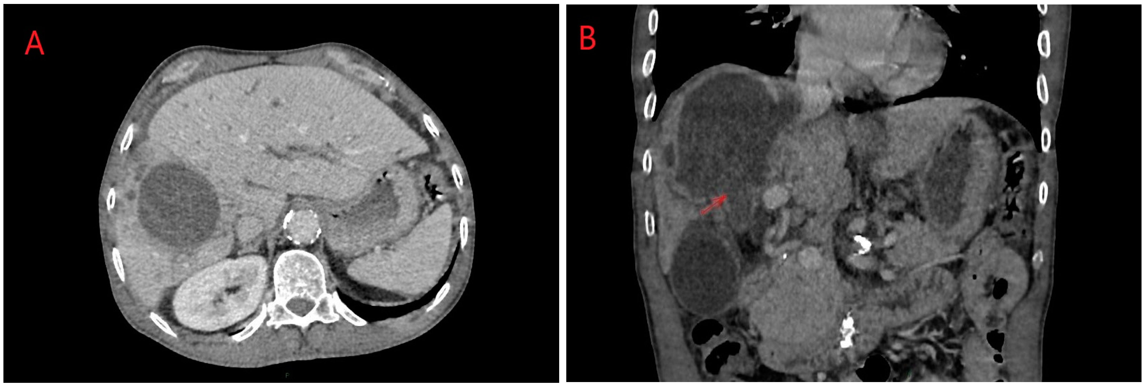 Diagnostics 14 01346 g003 Diagnostics 14 01346 g003