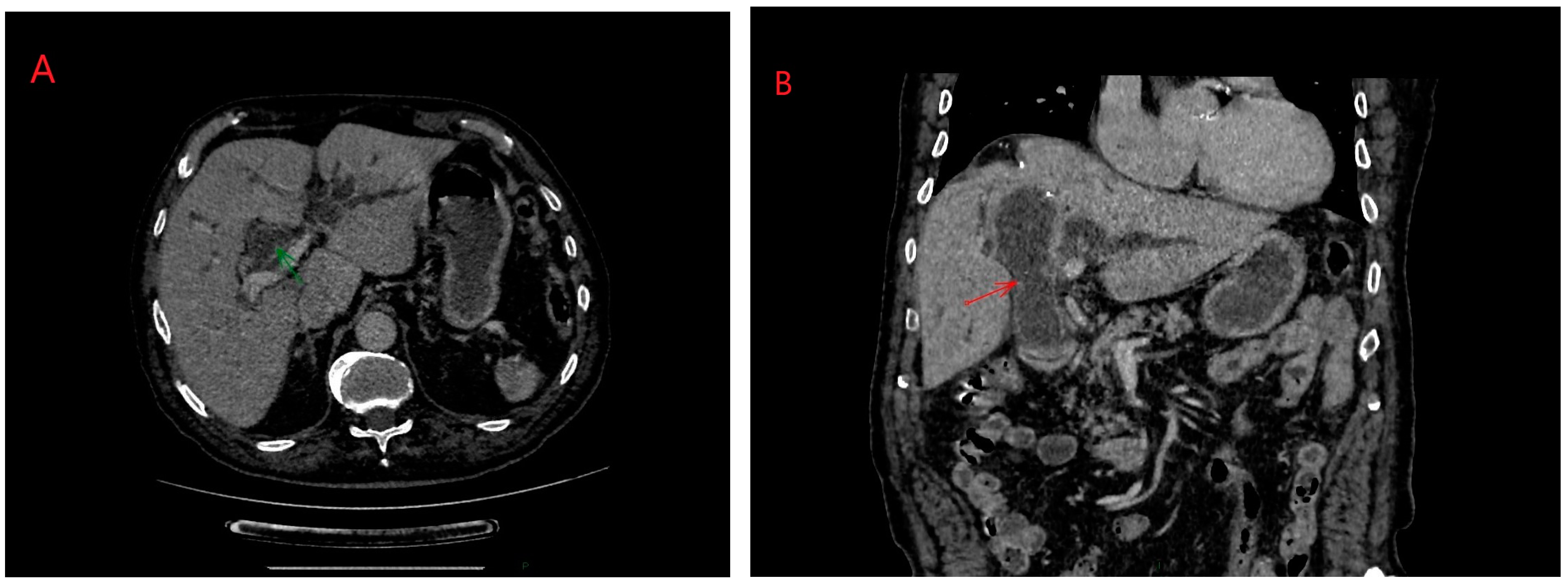 Diagnostics 14 01346 g004 Diagnostics 14 01346 g004