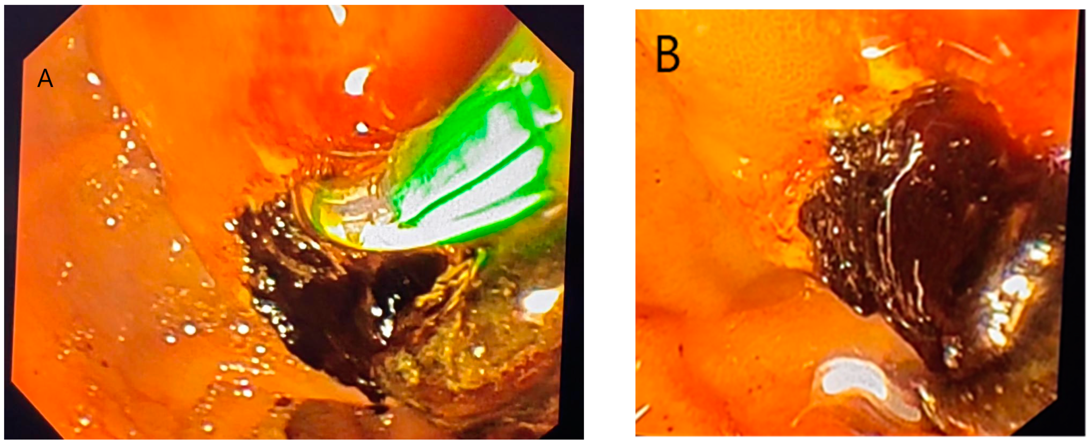 Diagnostics 14 01346 g005 Diagnostics 14 01346 g005