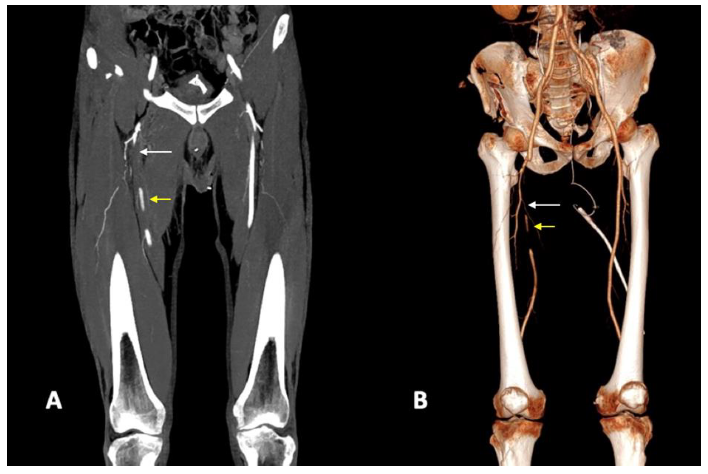 Diagnostics 14 01356 g004