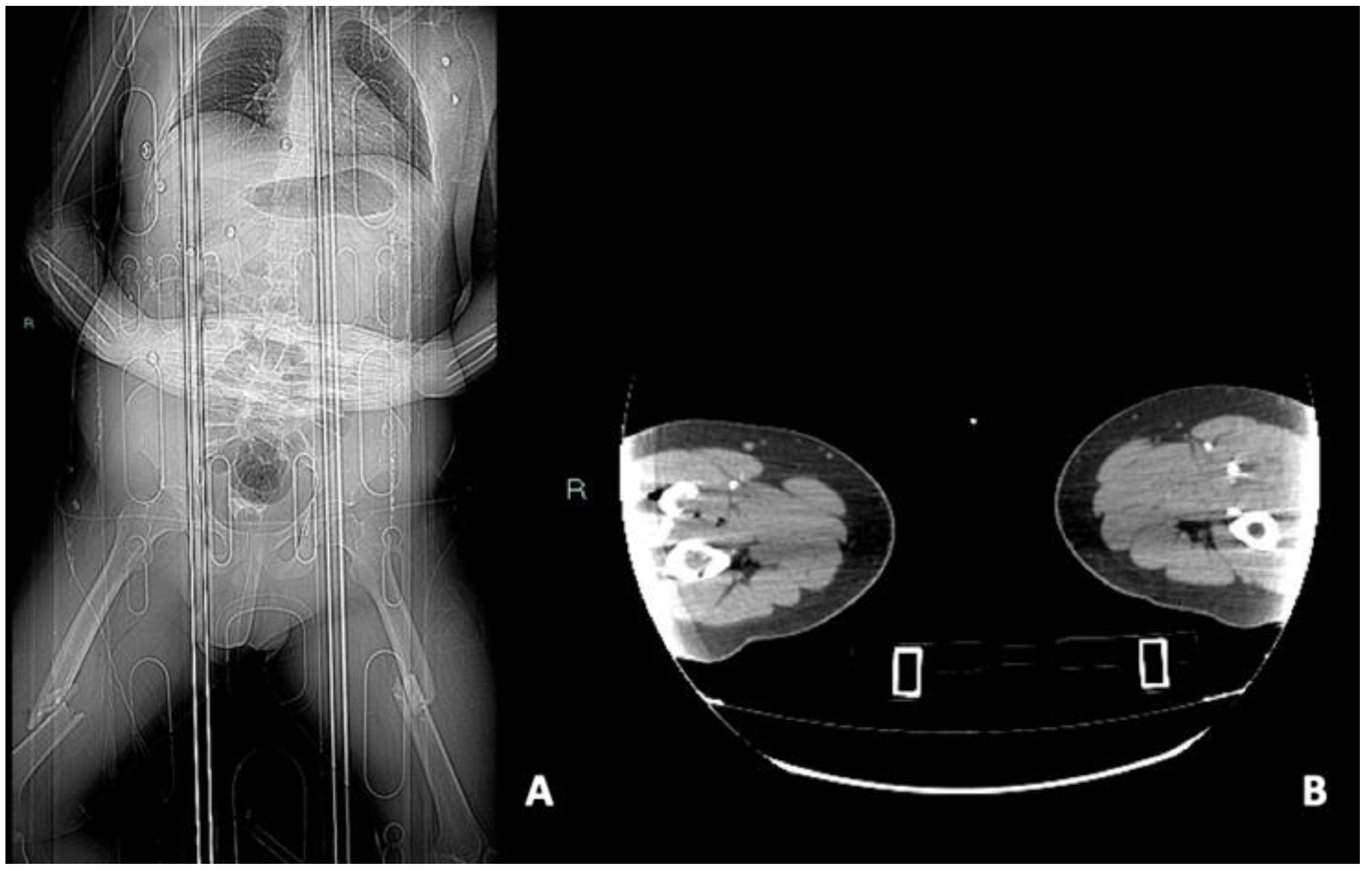 Diagnostics 14 01356 g008