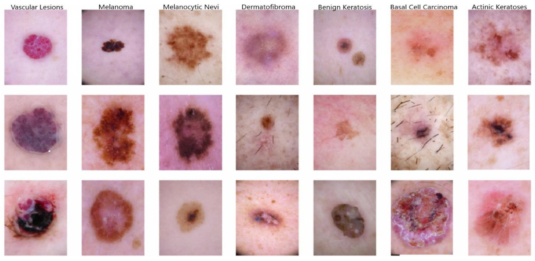 Diagnostics 14 01359 g002