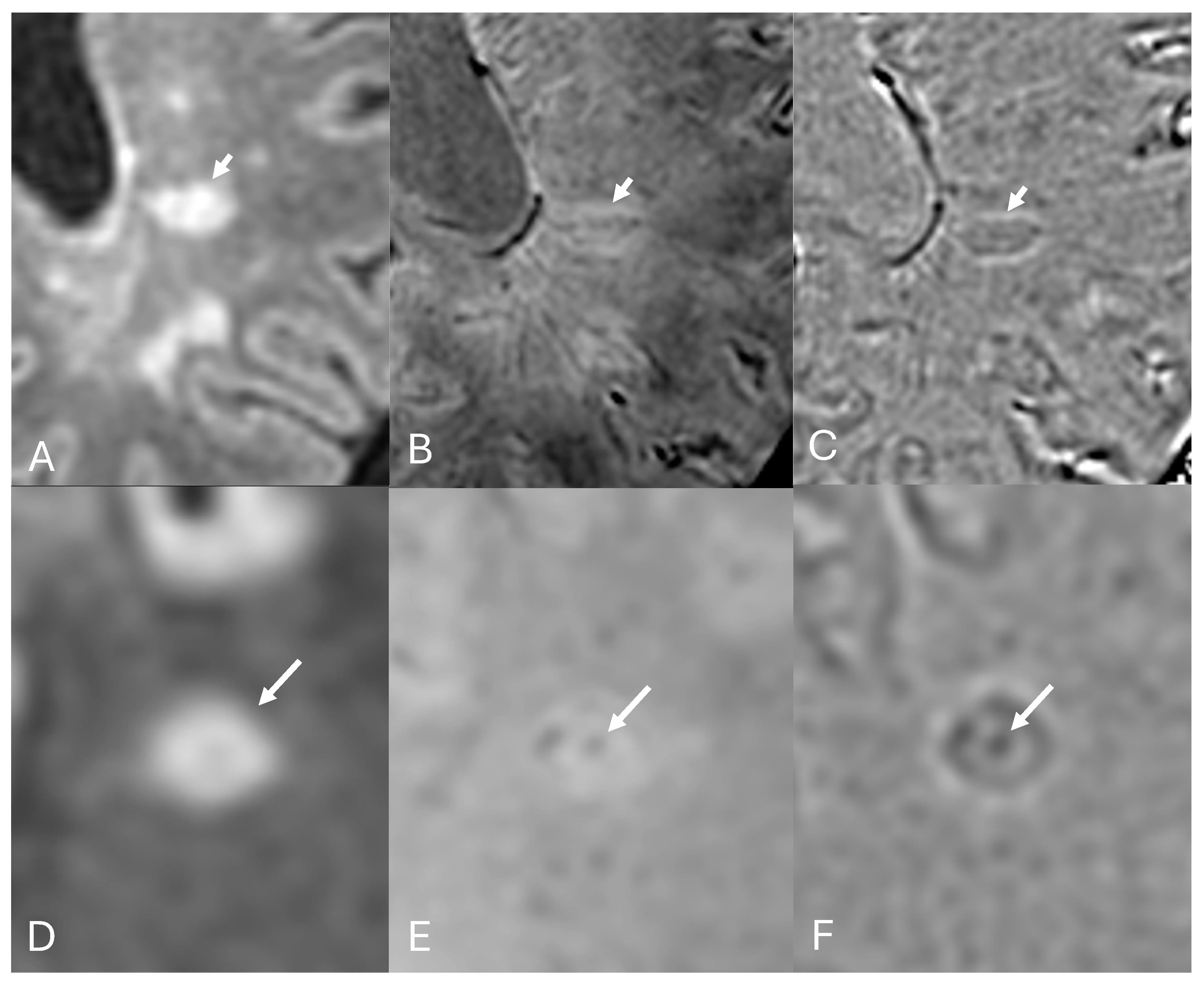 Diagnostics 14 01362 g005