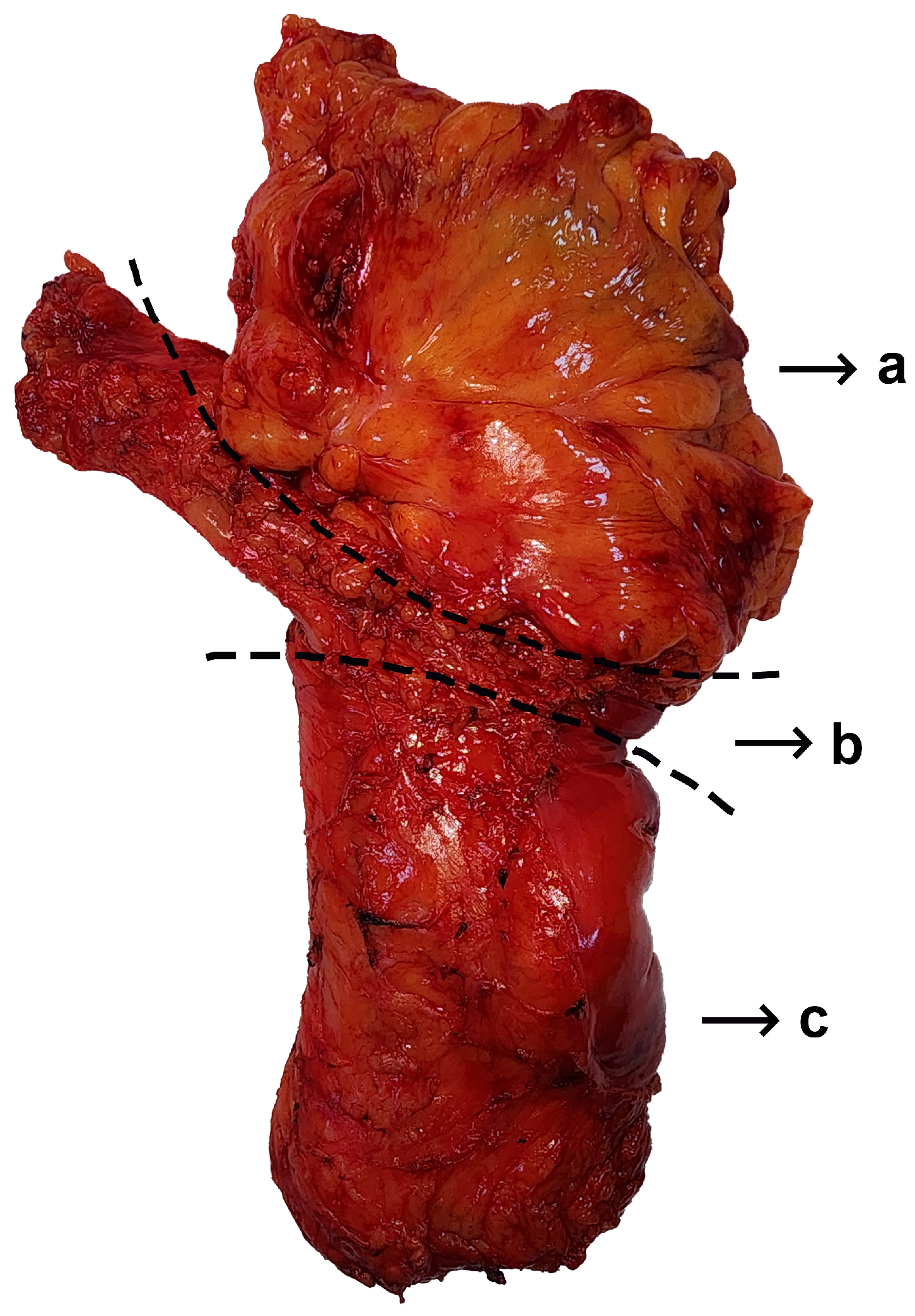 Diagnostics 14 01363 g002