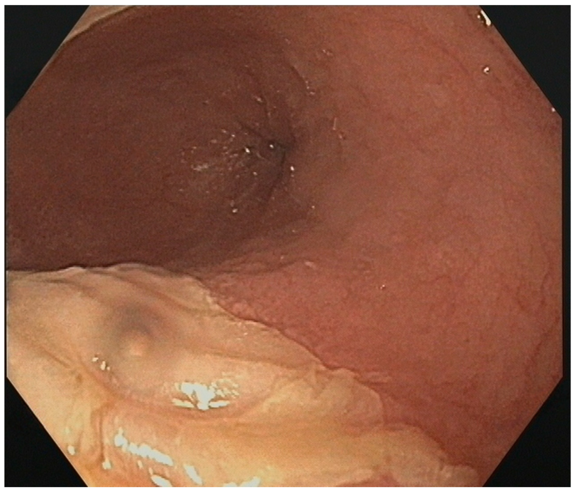 Diagnostics 14 01370 g003