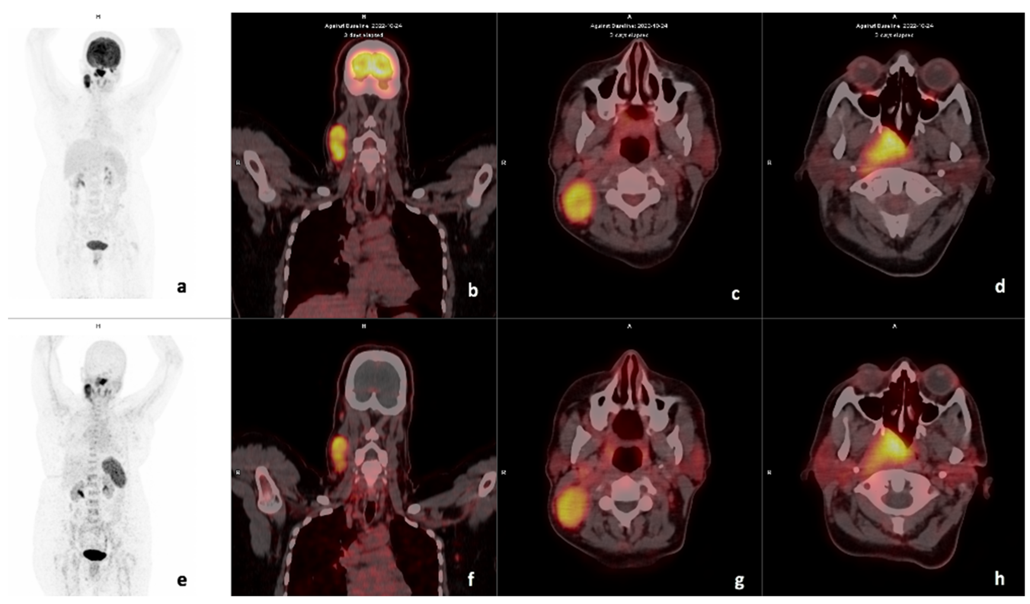 Diagnostics 14 01375 g003 Diagnostics 14 01375 g003