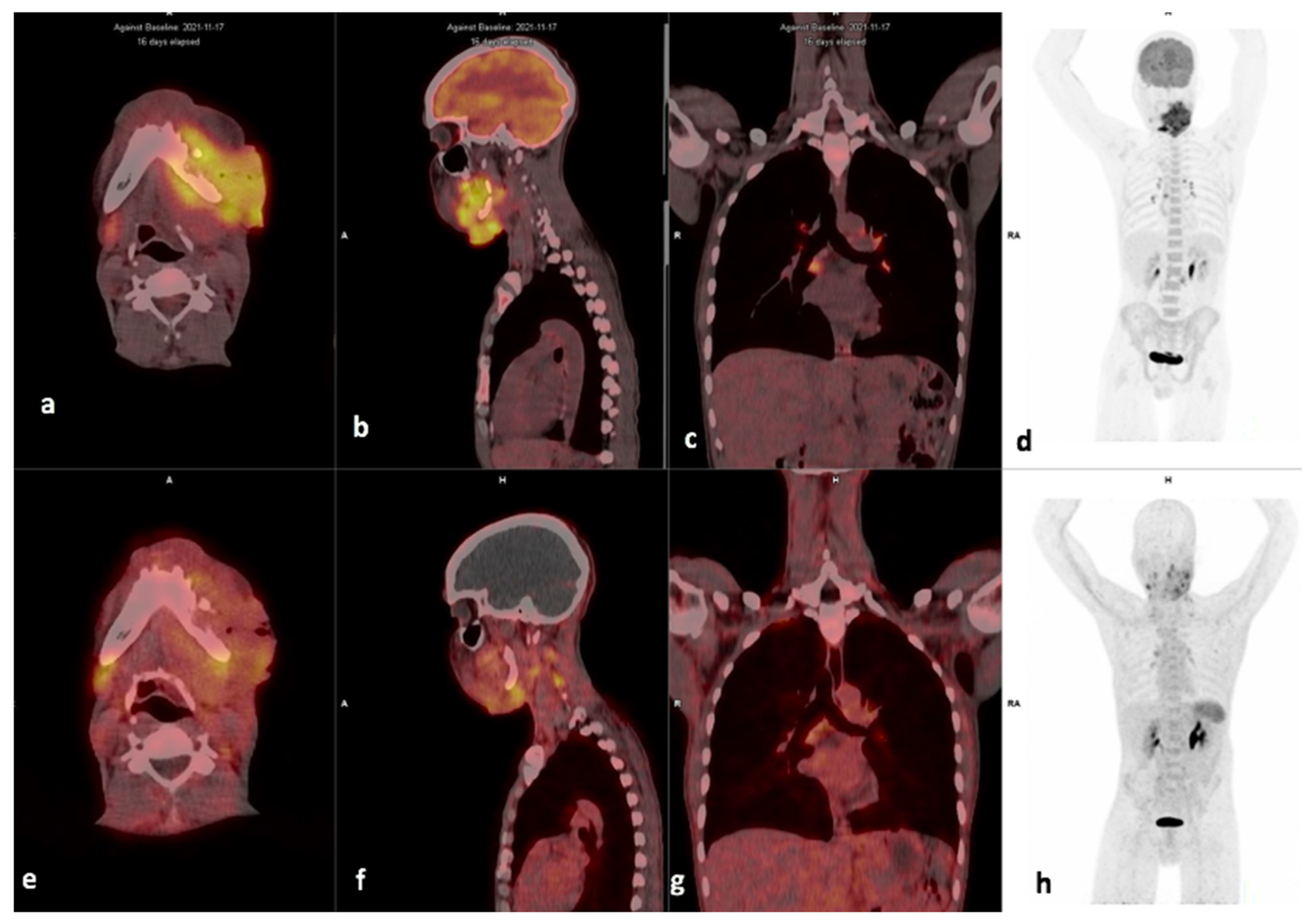 Diagnostics 14 01375 g005 Diagnostics 14 01375 g005