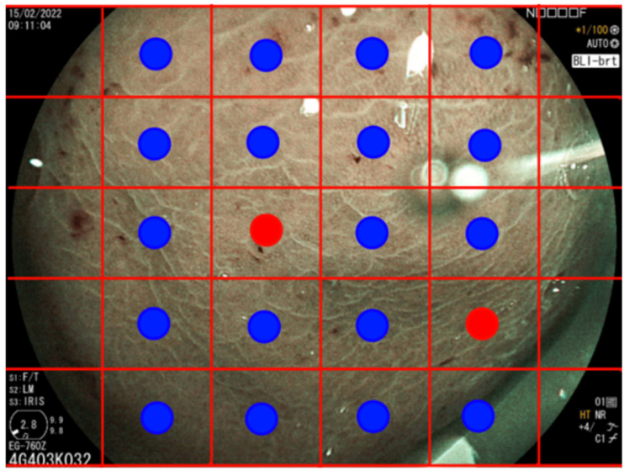 Diagnostics 14 01376 g003