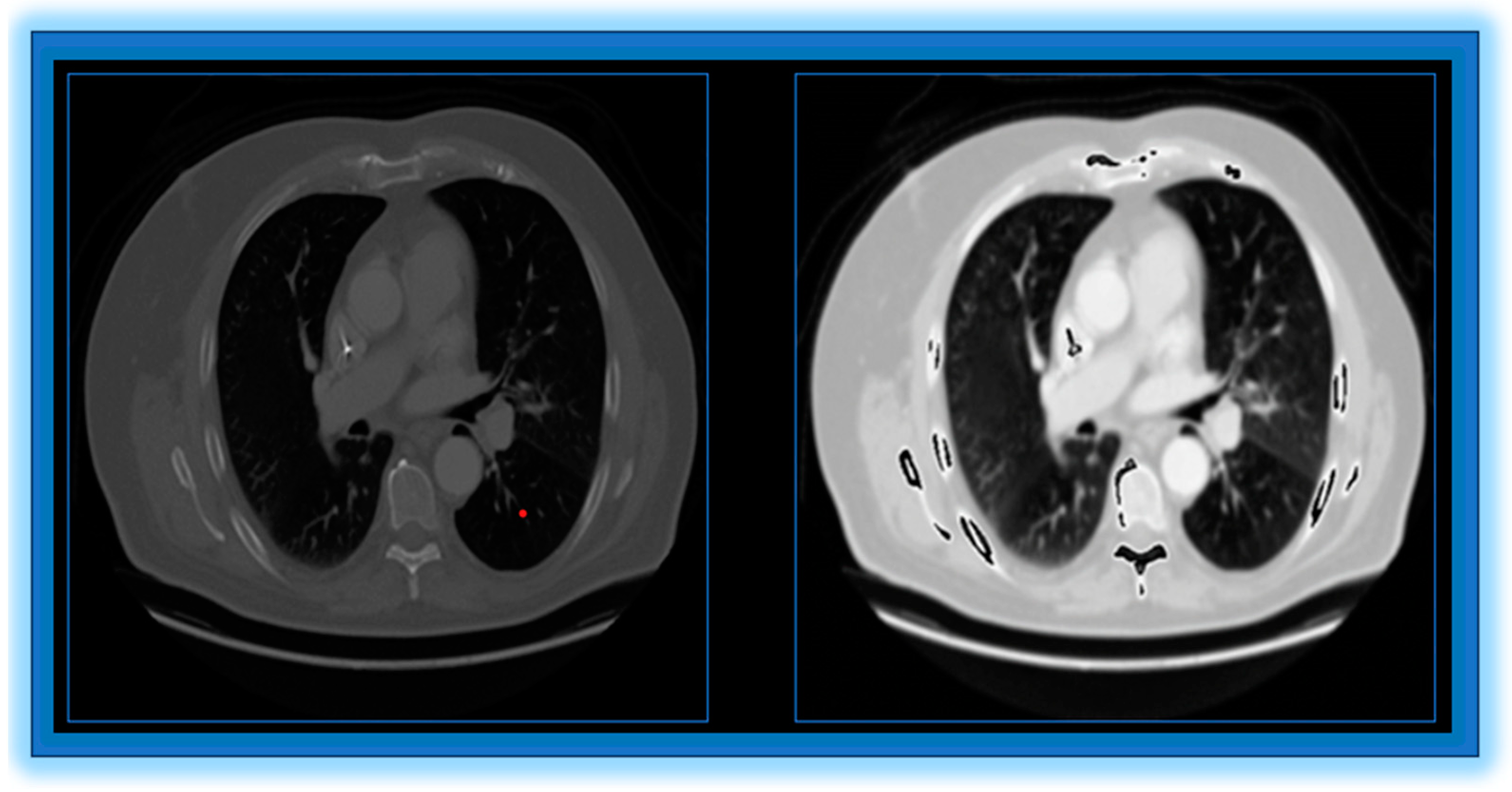Diagnostics 14 01378 g003