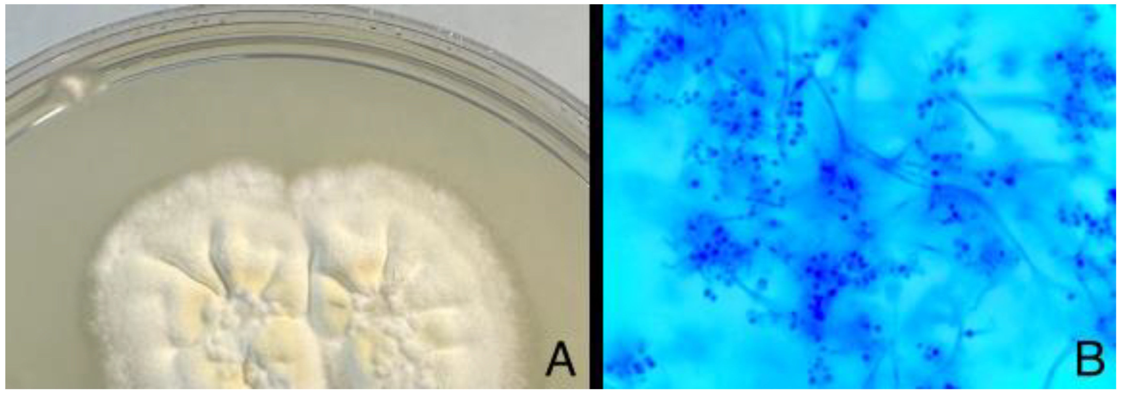 Diagnostics 14 01382 g005