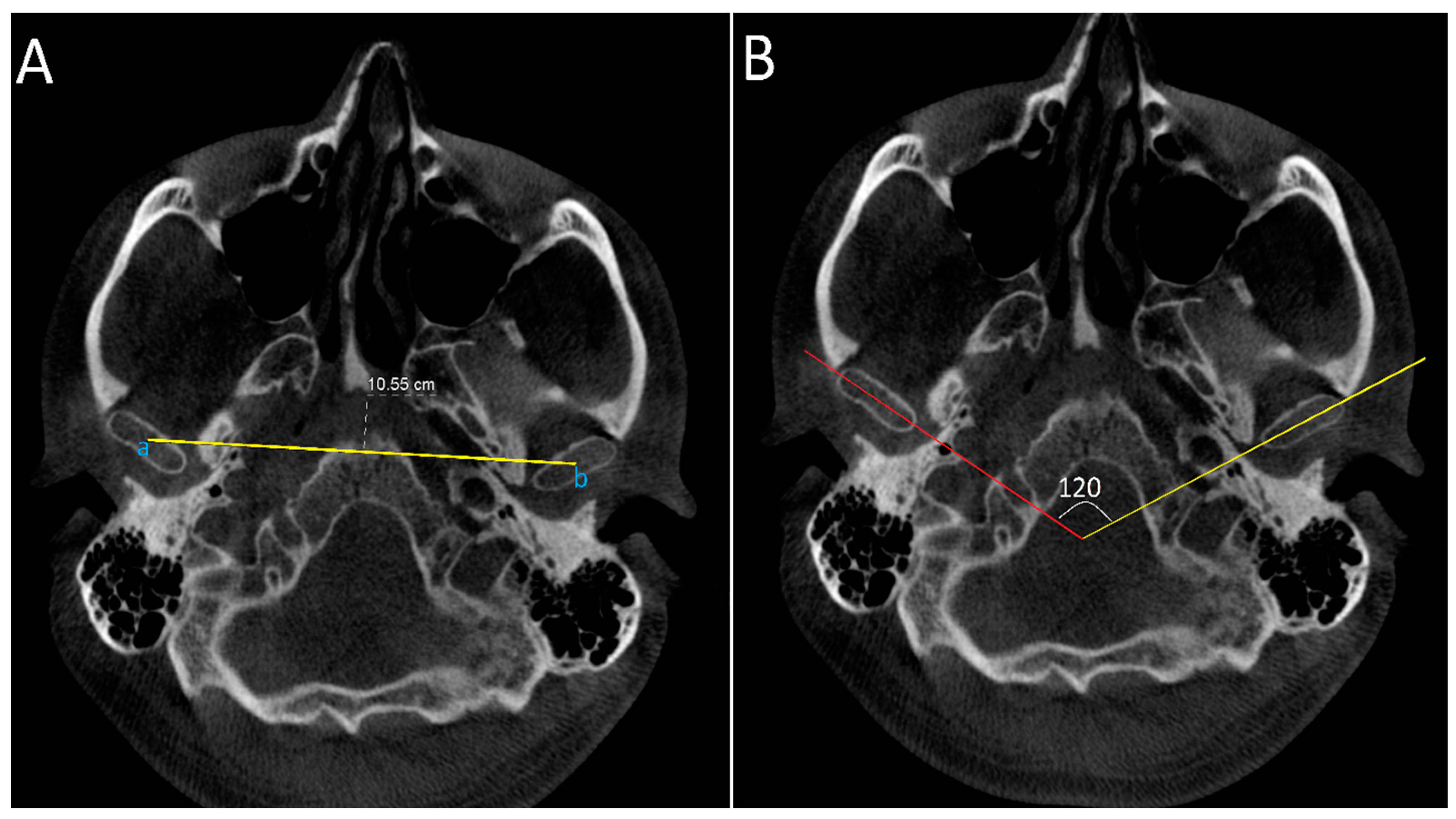 Diagnostics 14 01389 g002