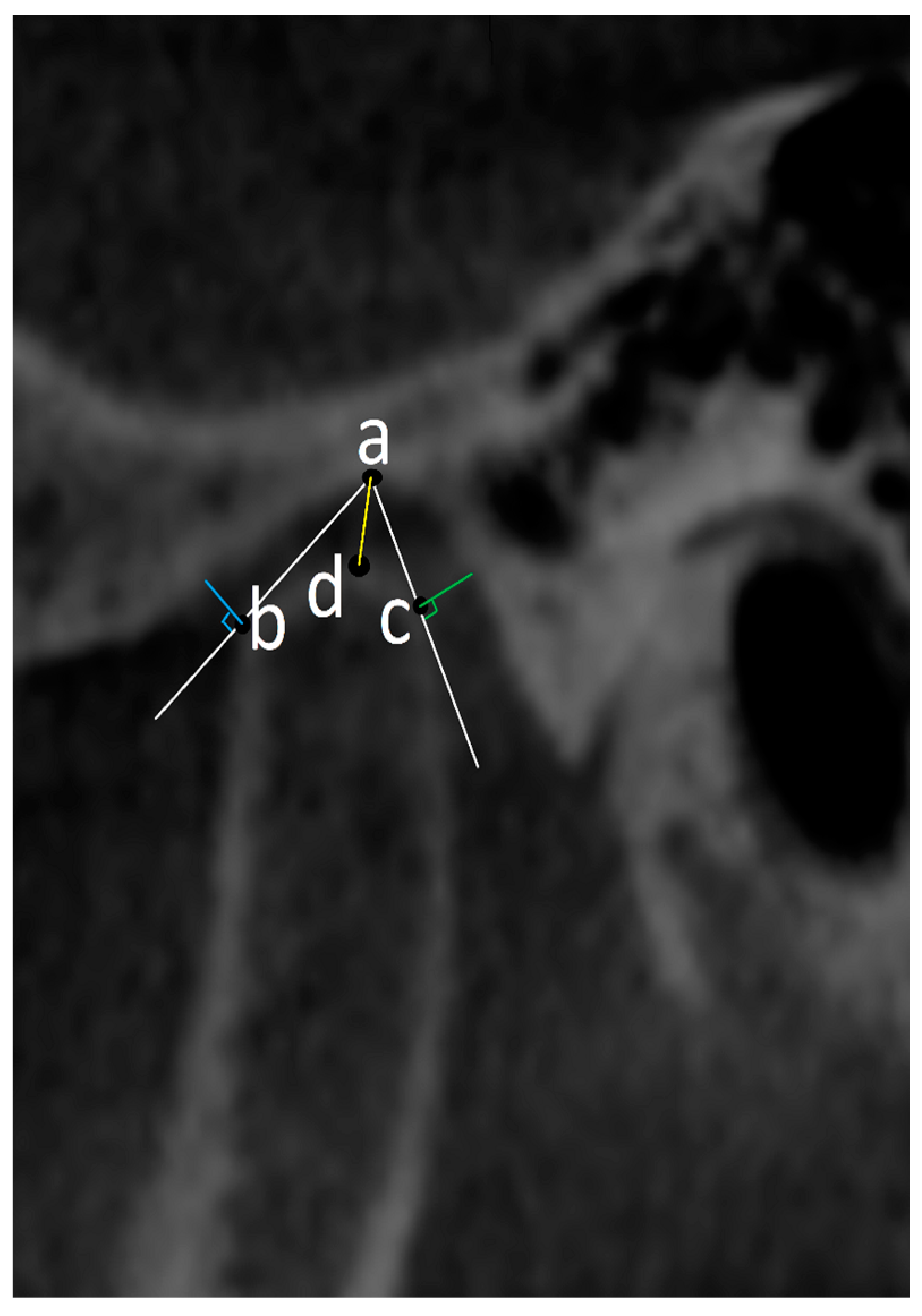 Diagnostics 14 01389 g003