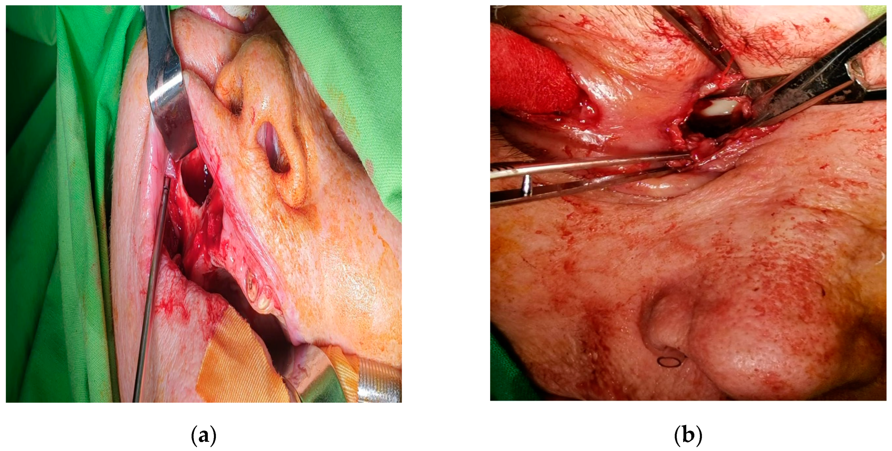 Diagnostics 14 01391 g005