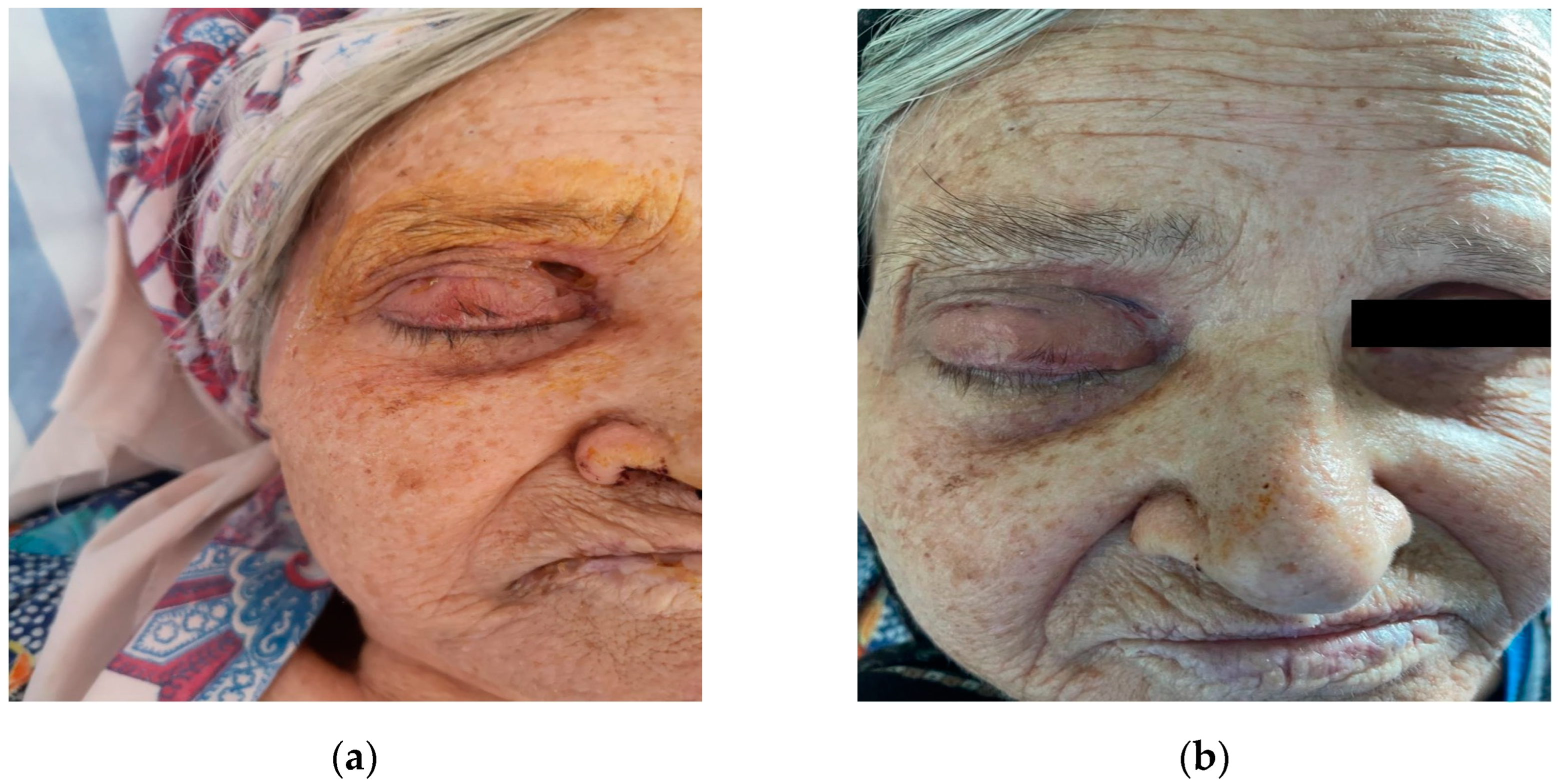 Diagnostics 14 01391 g008